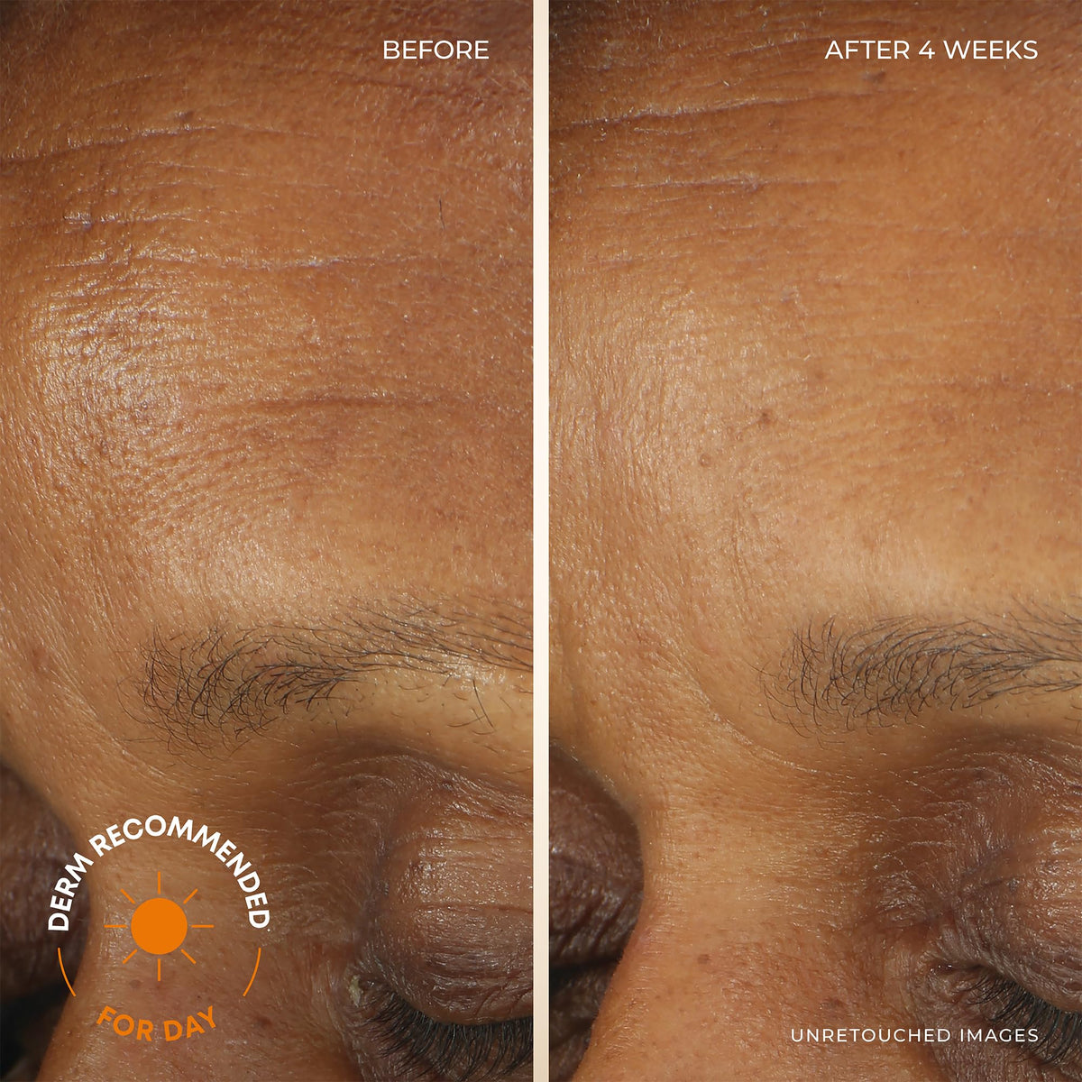 RoC Retinol Correxion Deep Wrinkle Facial Moisturizer Skin - RoC Official Imagery - 3