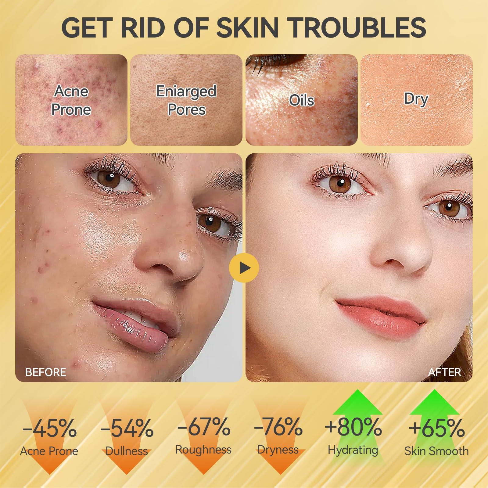 Skin Care Set, Face Snail Revitalizing Skin Care Sets &amp; - Onkessy
