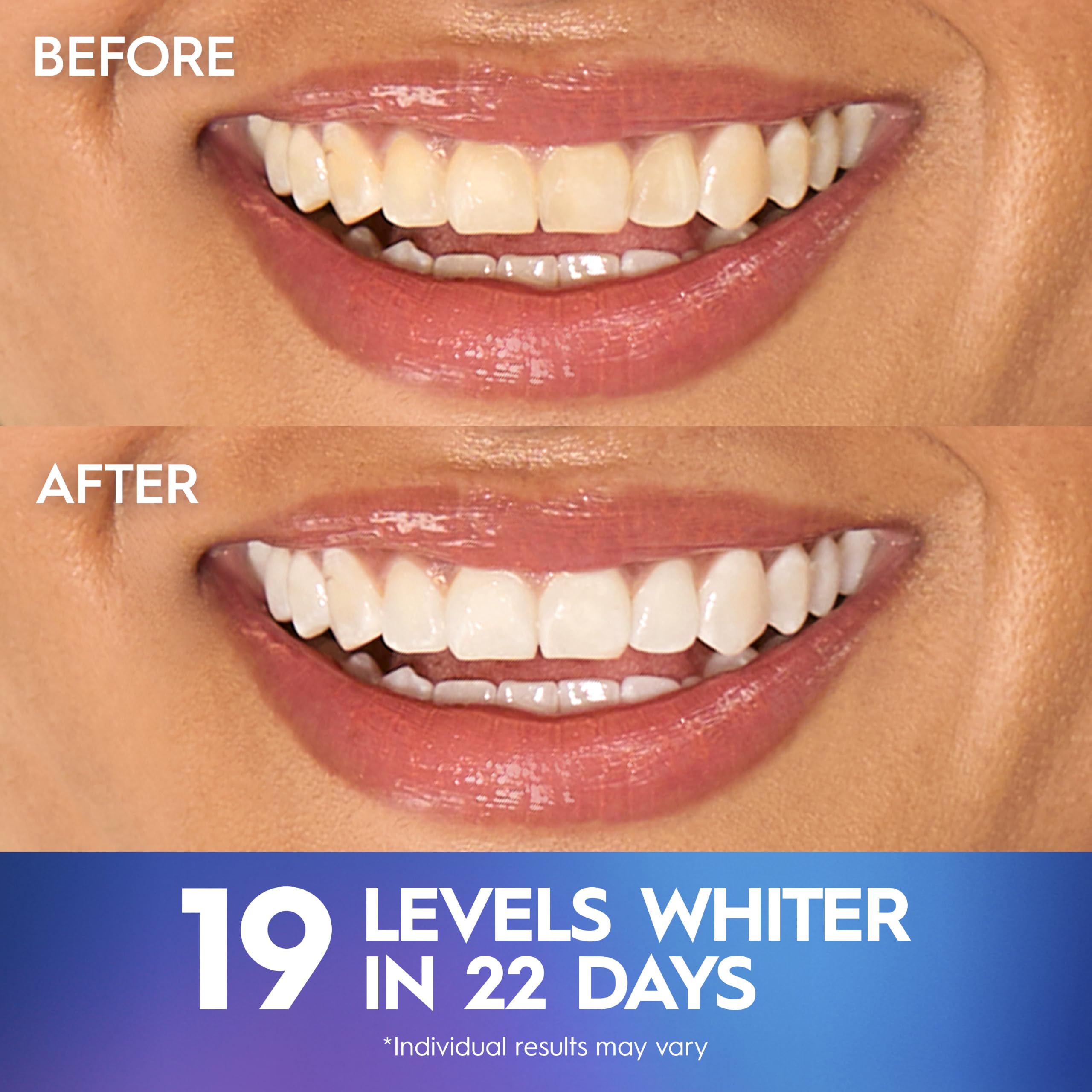 Crest Teeth Whitening Strips, Crest 3D Whitestrips Professiona... - Crest Official Product View 5