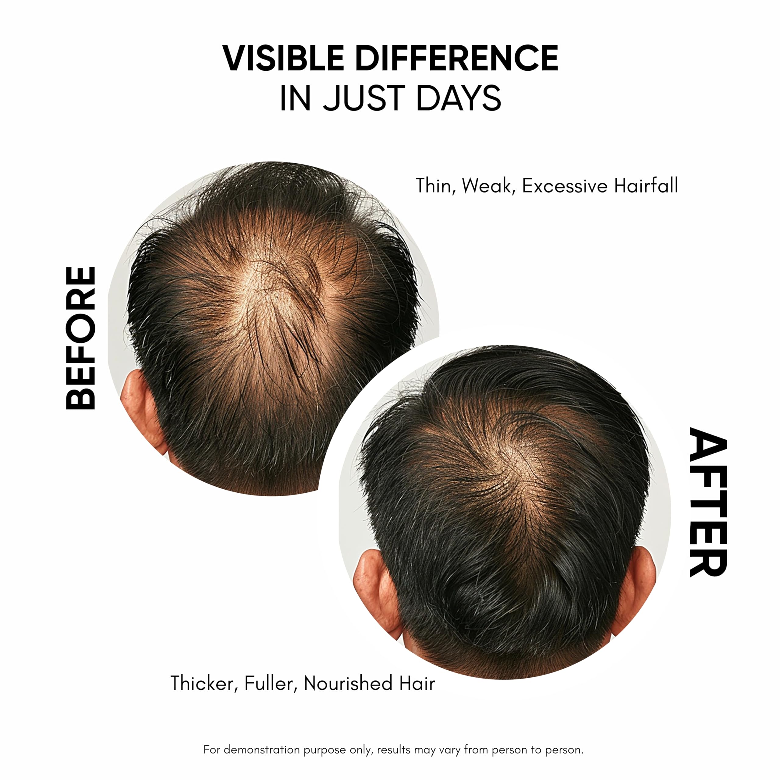 Masofta Hair Growth Serum For Density, Hair fall Control with 3% Redensyl, 5% - Masofta Official Product View 4