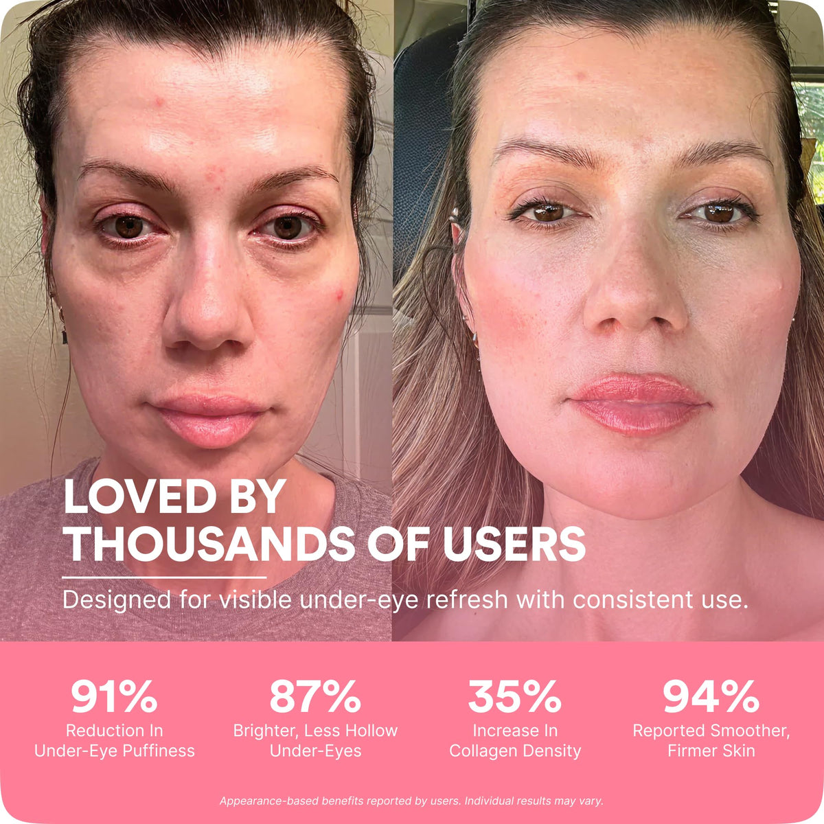 RevitalEyes Under Eye Bags Red Light Tool for Dark Circles - BOTANIQUE PARIS Official Imagery - 5