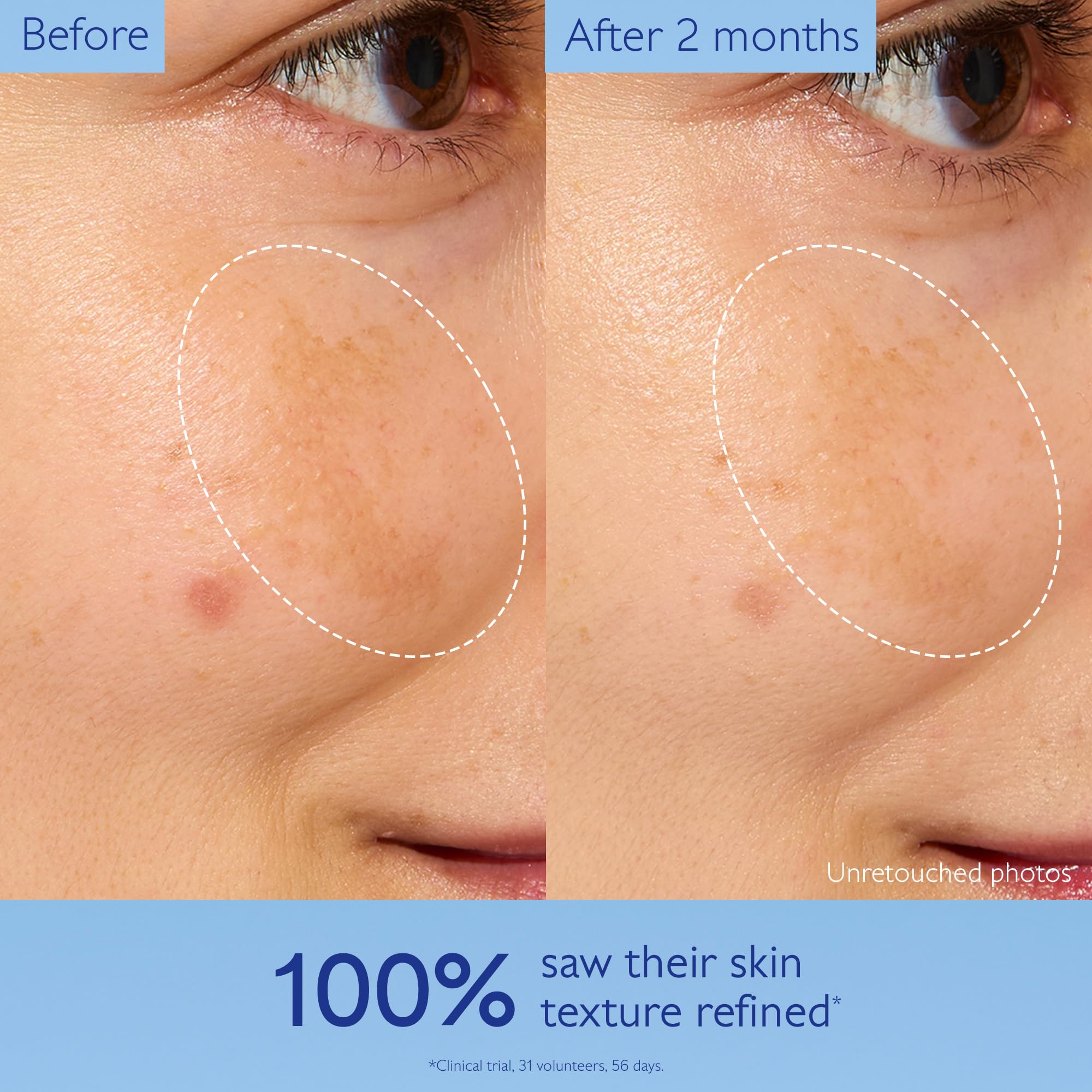 Caudalie Vinoperfect Brightening Essence Glycolic Acid Toner - Premium Selection Official Imagery - 5