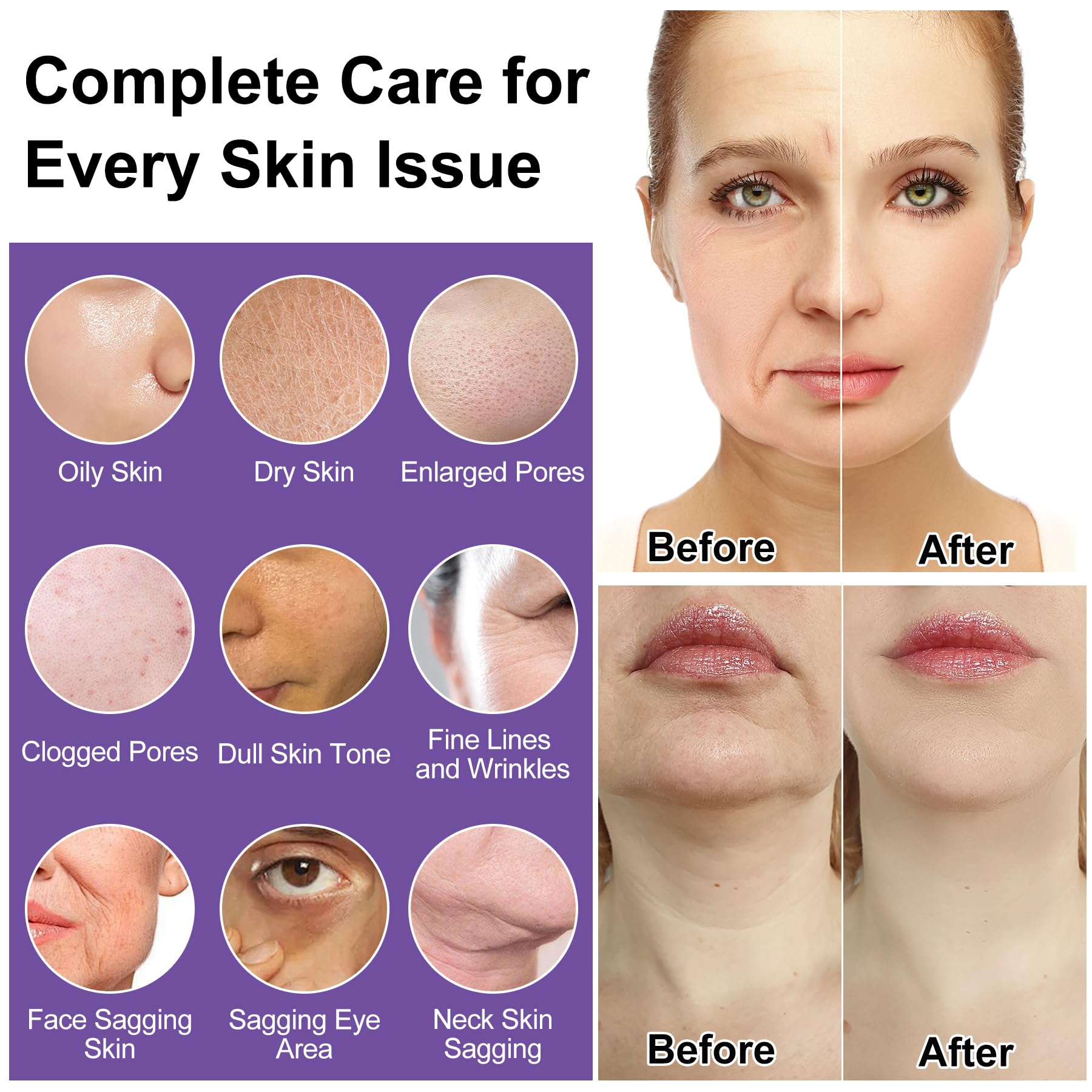 Skin Care Set,6Pcs Tighten, Lift, Firm, Hydrate &amp; Radiant - DOYEEWO