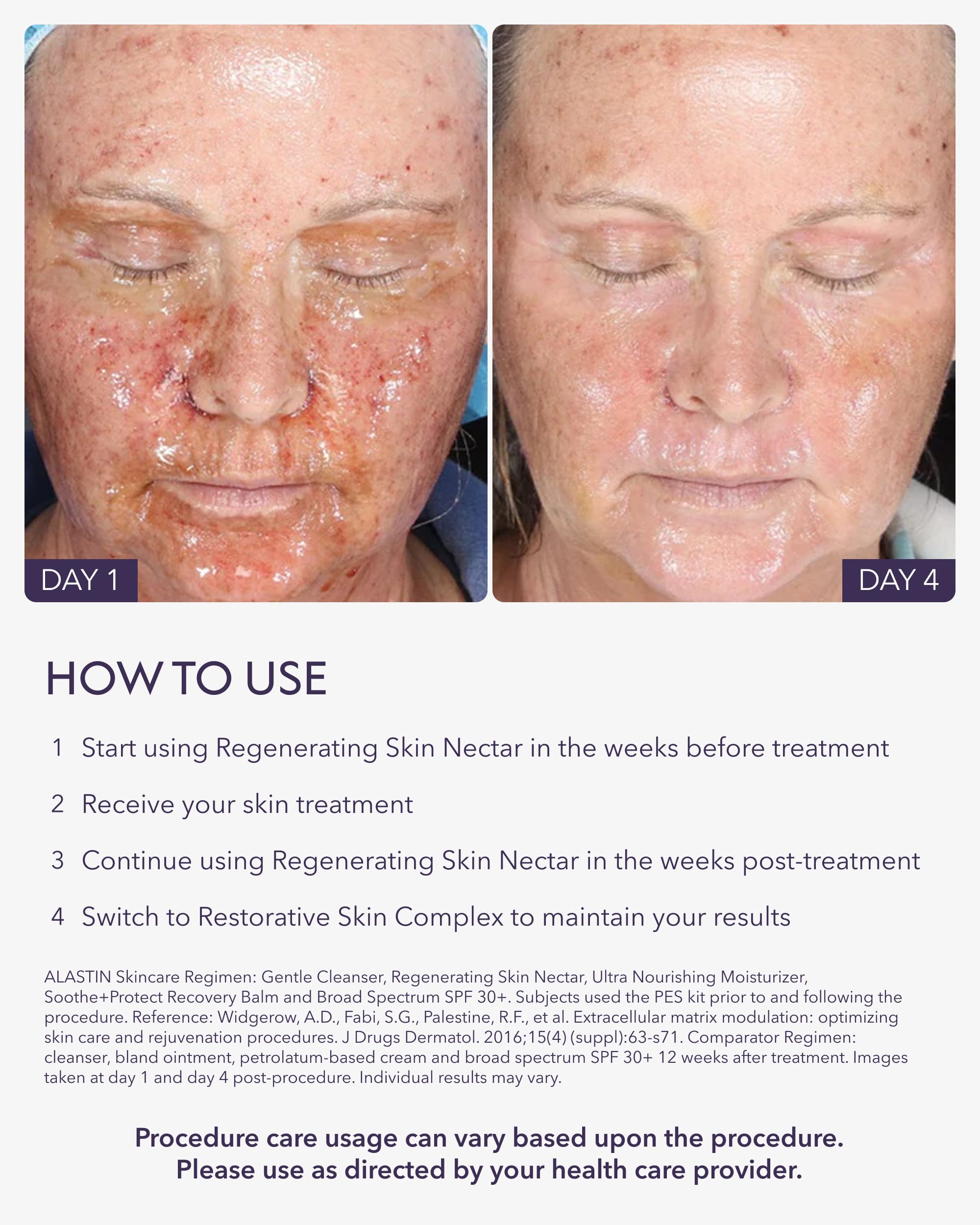 ALASTIN Skincare Regenerating Skin Nectar Face Moisturizer (1 oz) - ALASTIN Skincare Official Product View 6