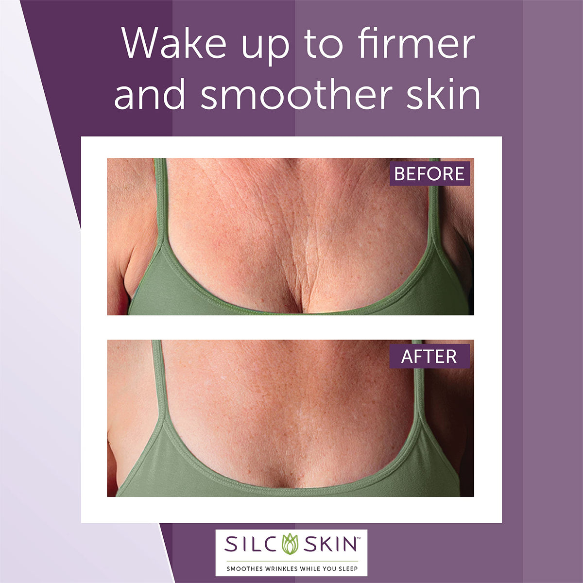 Silc Skin Decollette Pad for Chest Wrinkles 30 Day Supply - Silc Skin Official Imagery - 4