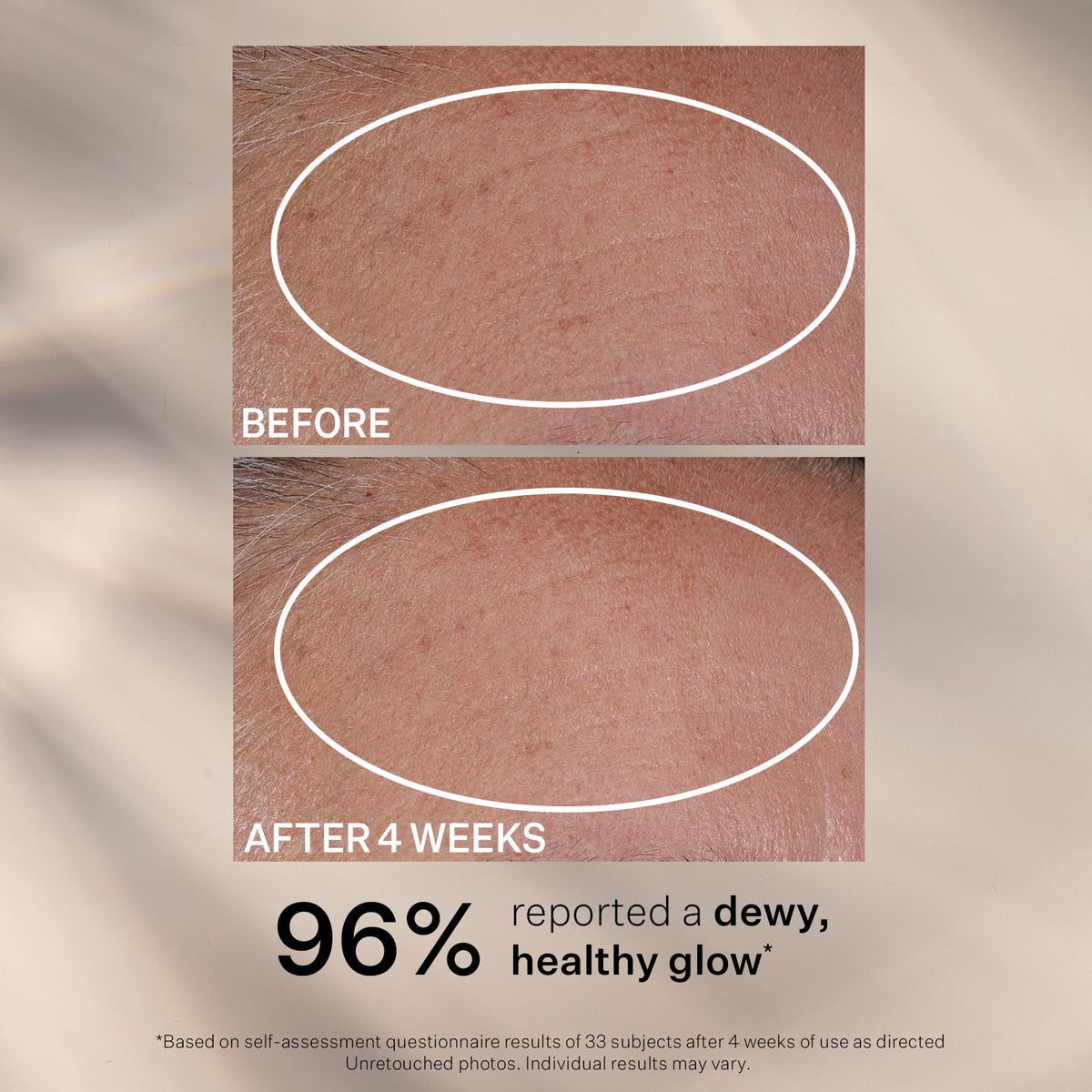 StriVectin Hydration Multiplier 2 in 1 Serum - StriVectin Official Imagery - 7