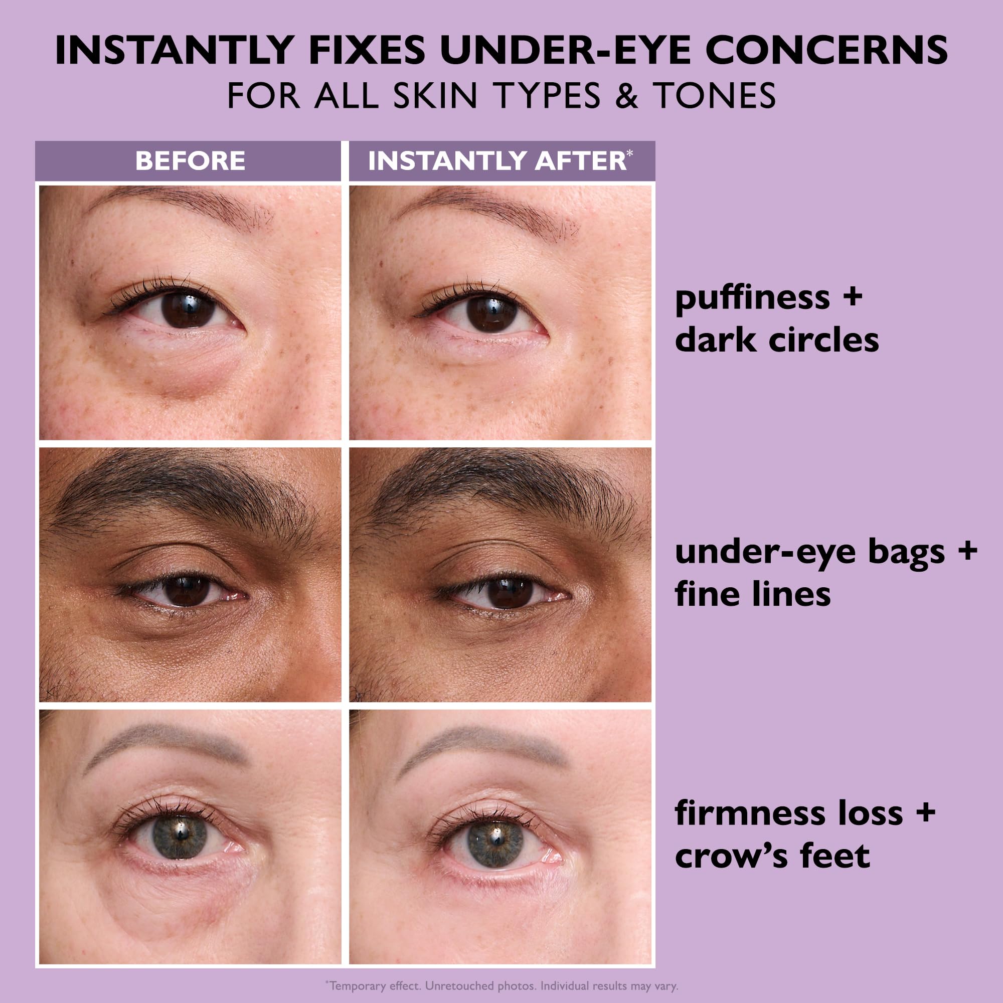 Elefair Tech Peter Thomas Roth - Instant FIRMx® Eye Temporary Eye Tight - Elefair Tech Official Product View 8