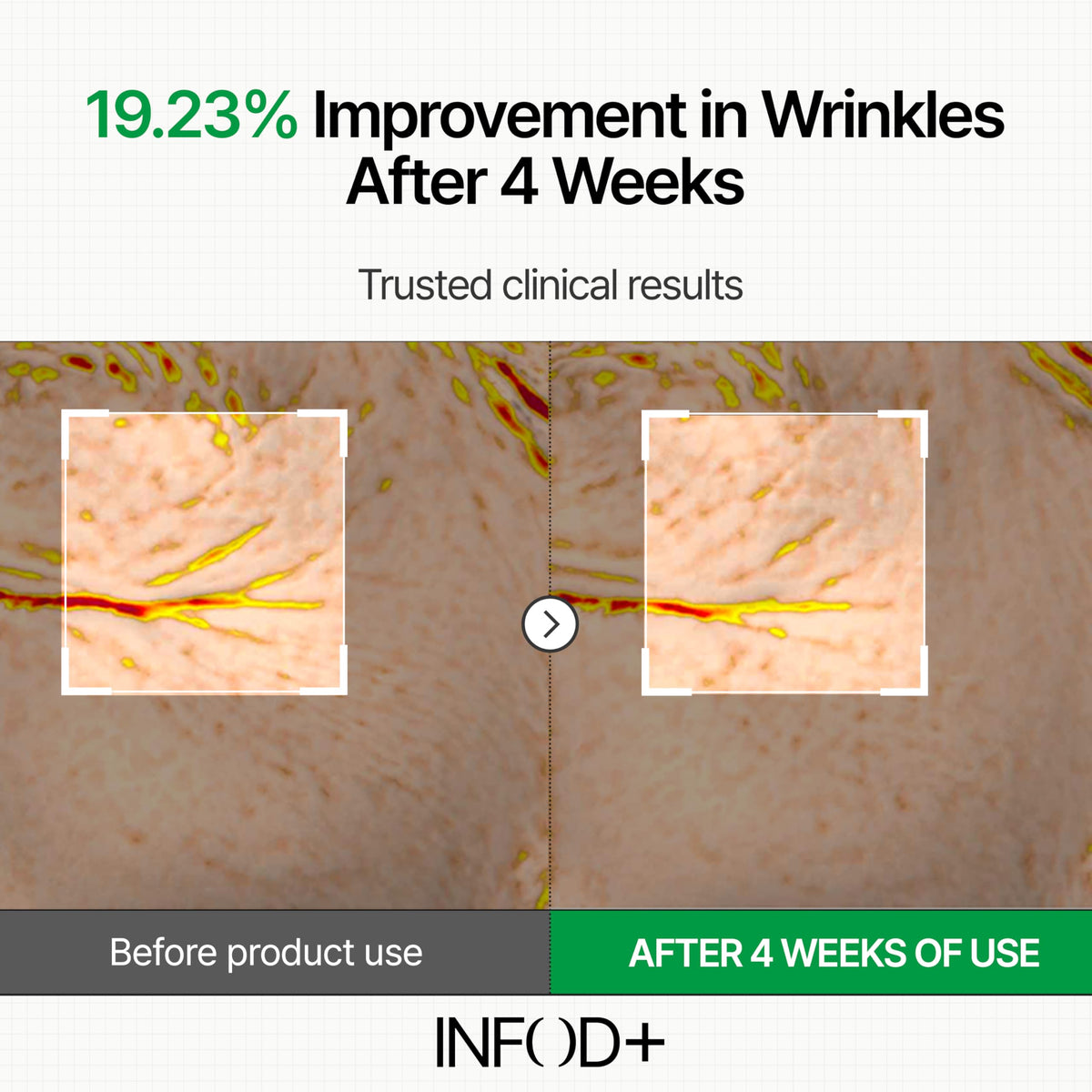INFODPLUS Sensitive Skin Moisturizer Face Cream with - INFOD+ Official Imagery - 4