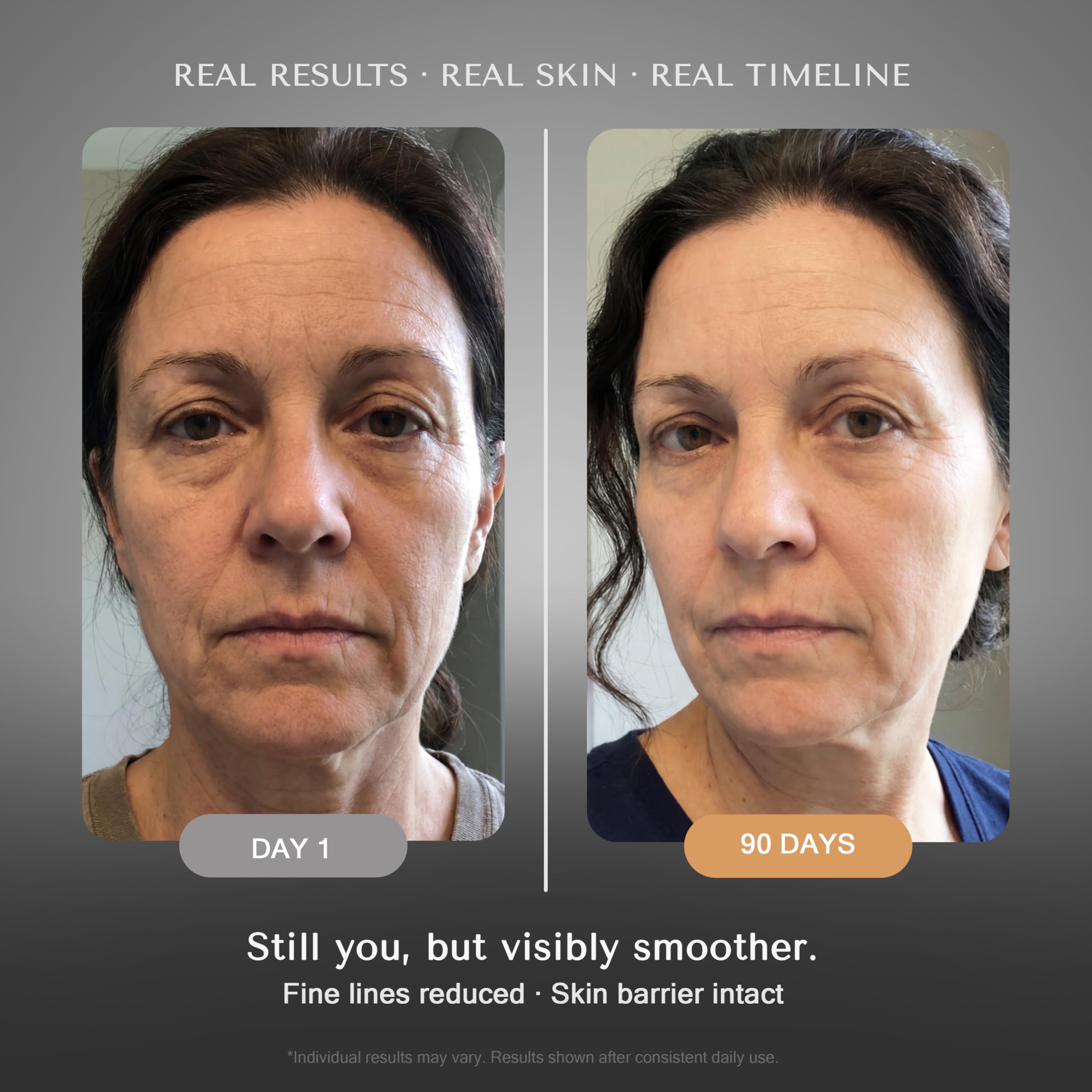 SOLURETINOL Retinol Serum for Face Wrinkles – Skin Renewing Day & Night System - SOLURETINOL Official Product View 4
