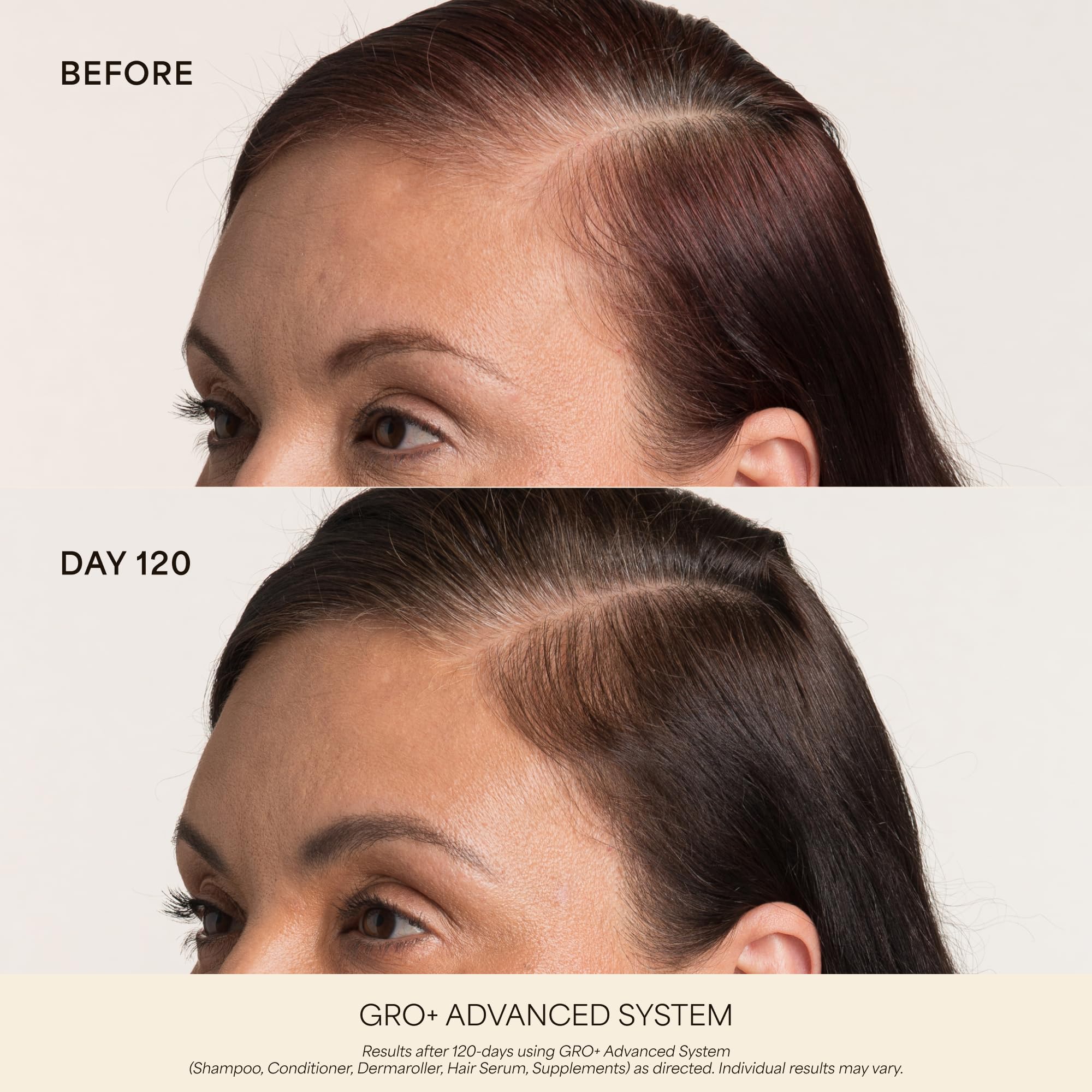 VEGAMOUR Scalp Dermaroller - Premium Selection Official Imagery - 5
