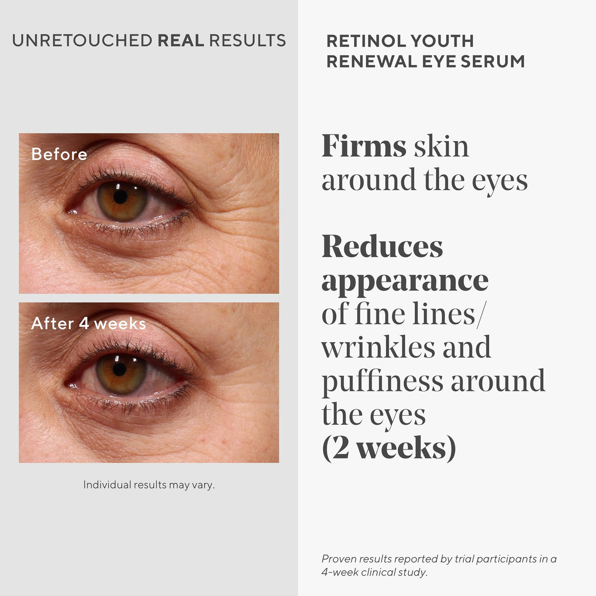 Murad Retinol Youth Renewal Eye Serum - Premium Selection Official Imagery - 4