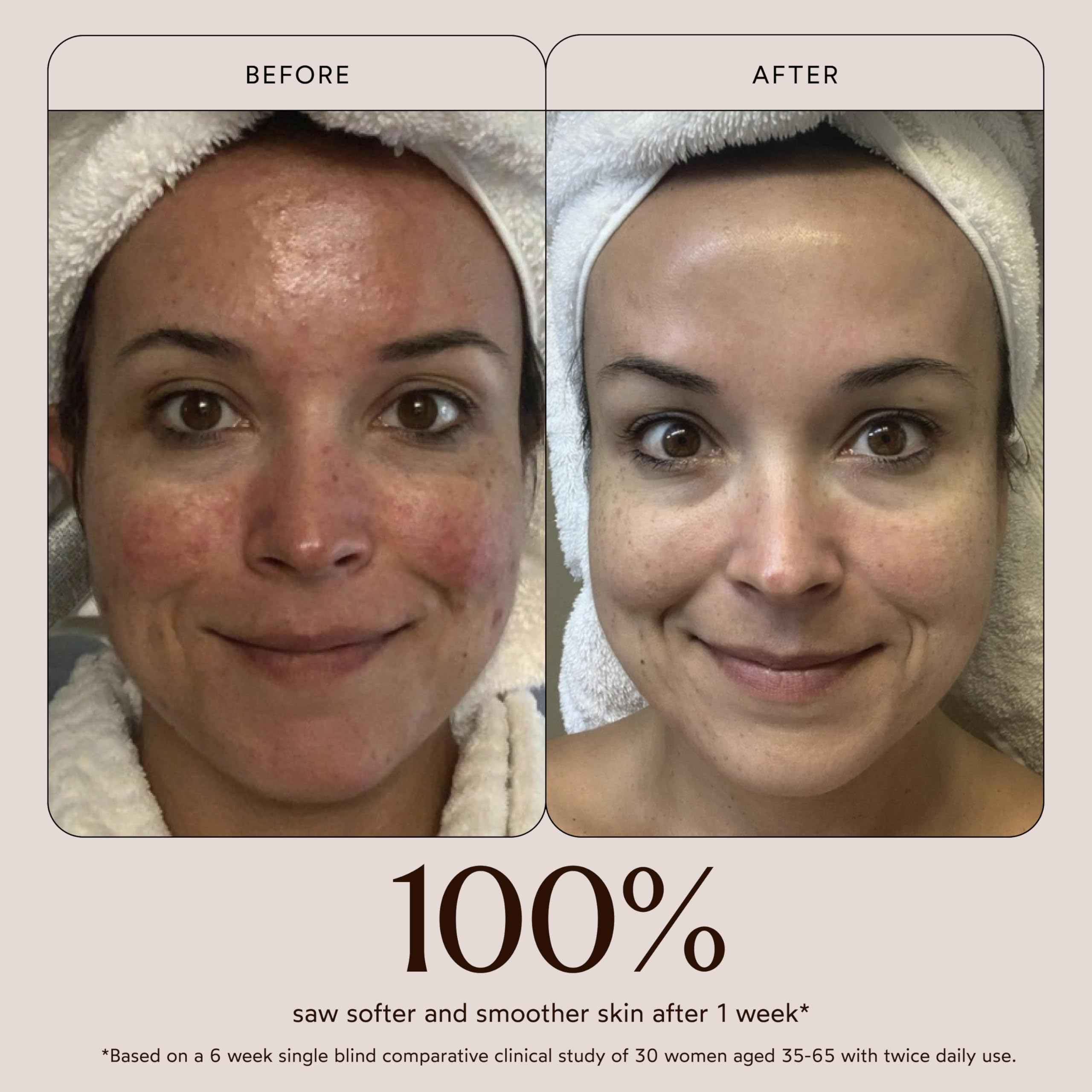 True Botanicals Chebula Active Serum - Anti Aging Face Serum Reduces Appearan - True Botanicals Official Product View 5