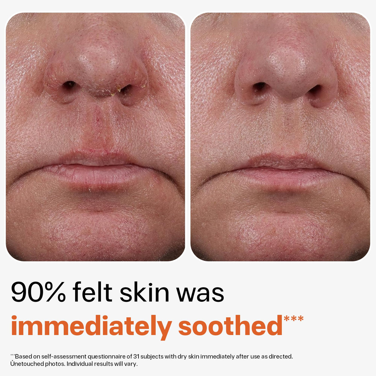 Triple Lipid Restore Anti Aging Face Moisturizer Lifting - OBOGEE Official Imagery - 7