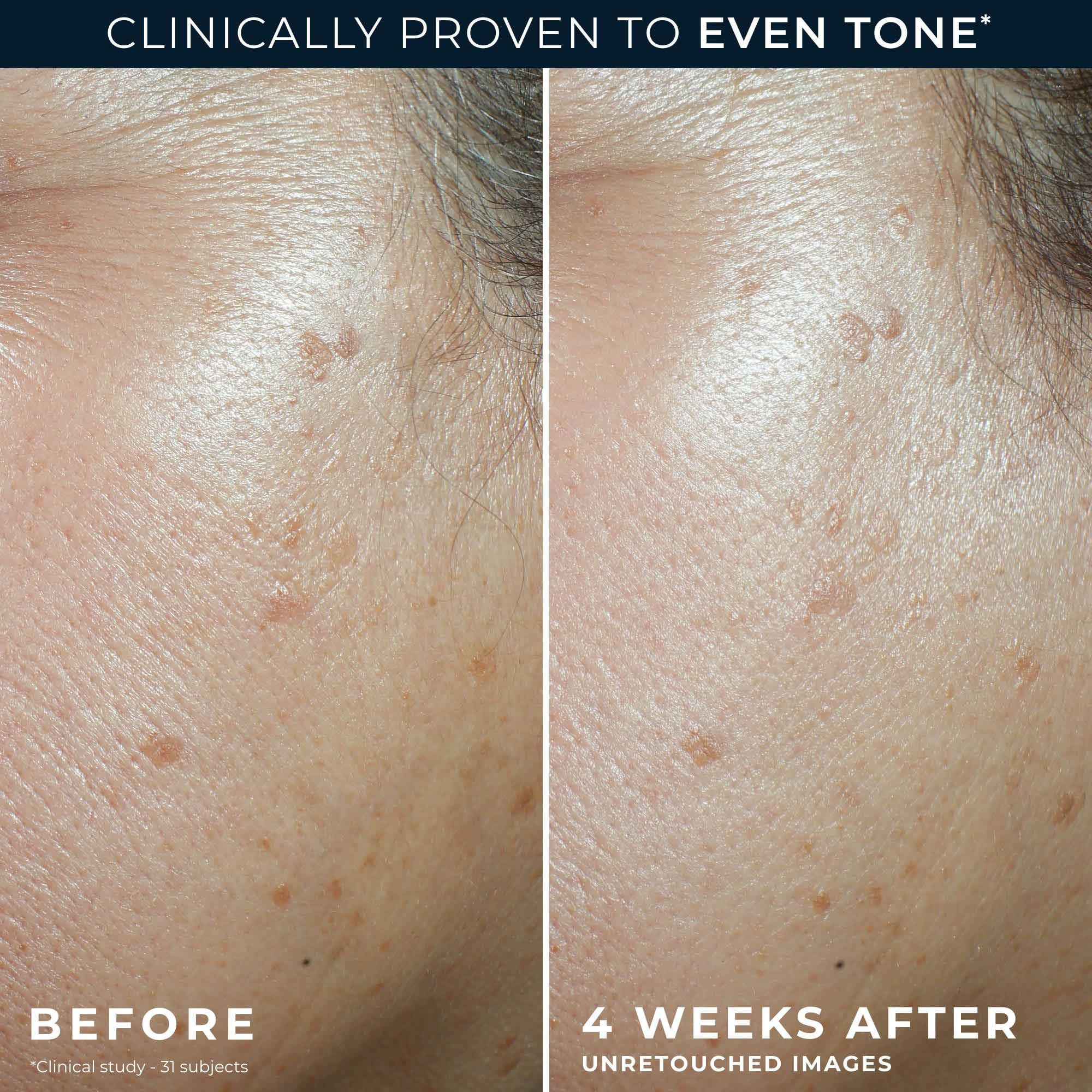 RoC Niacinamide Daily Face Moisturizer SPF 30 5 in 1 Even - RoC Official Imagery - 6