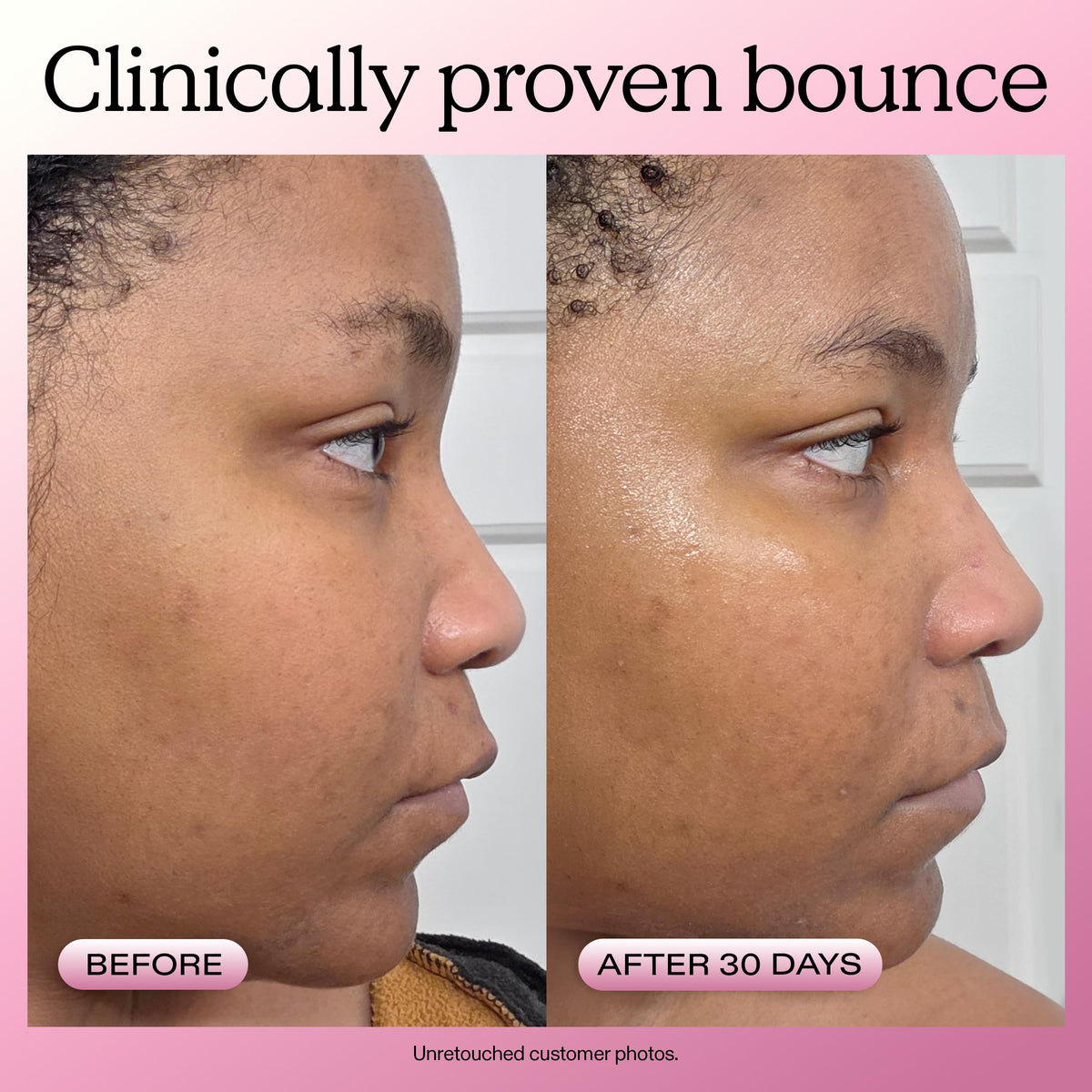 KraveBeauty Mochi Berrier Moisture Cream for Dry Sensitive - KraveBeauty Official Imagery - 6