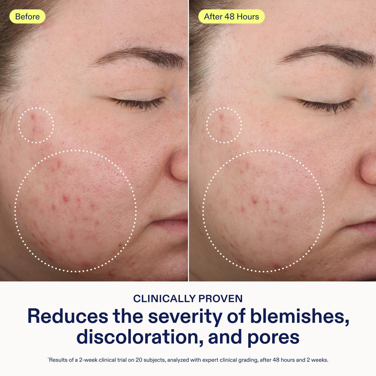 Skinfix 2 BHA Cleanser - Skinfix Official Imagery - 4