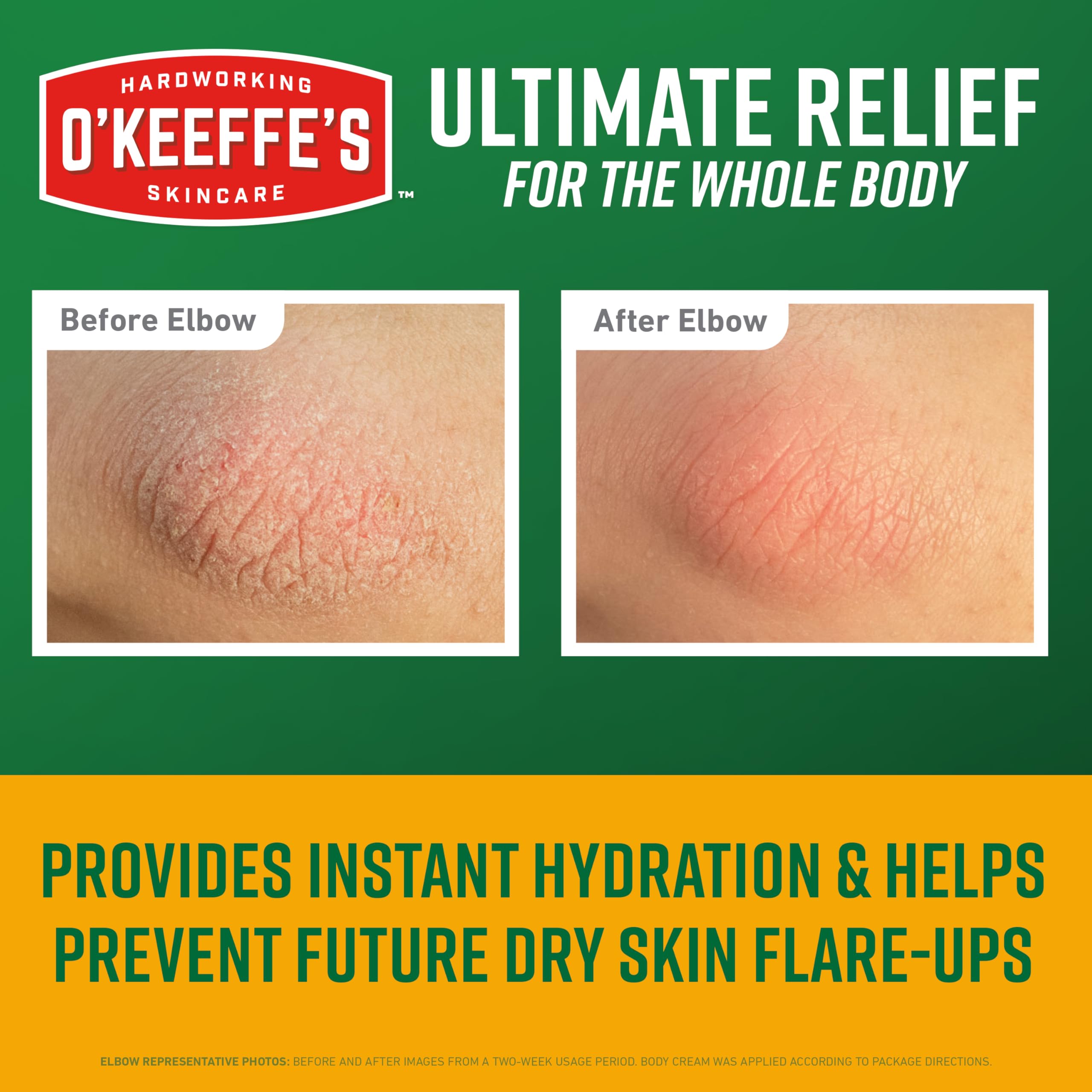 O'Keeffe's Skin Repair Body Cream in 7oz jar, moisturizing and soothing skin, ideal for dry and sensitive skin.
