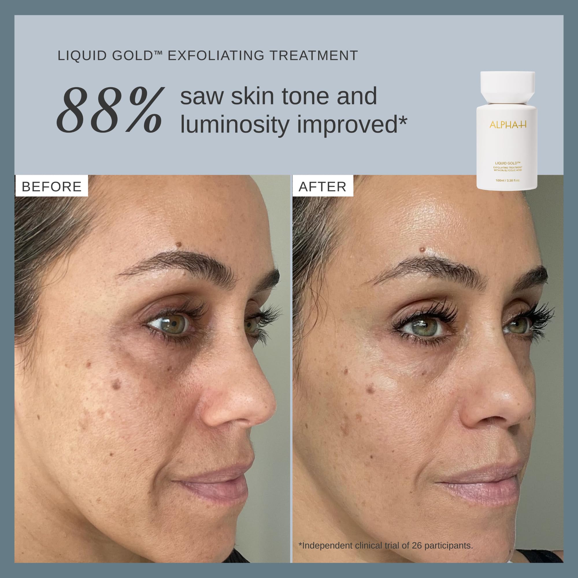 Alpha H Liquid Gold Exfoliating Treatment 5 Glycolic Acid - Premium Selection Official Imagery - 6