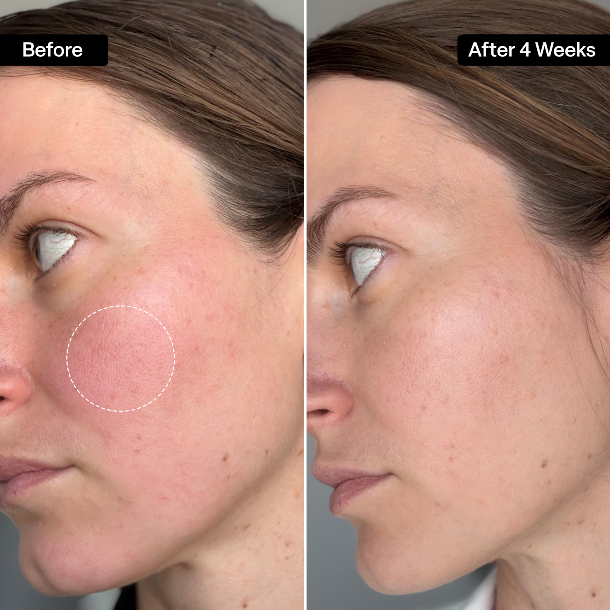 QRxLabs Squalane Oil for Face - Hydrating Face Oil with Vitamin E Derm - QRxLabs Official Product View 4