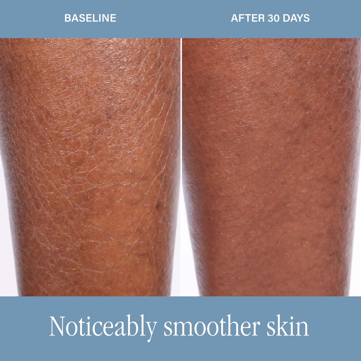 SKINN DermAppeal Exfoliating Body Scrub - SKINN Official Imagery - 7