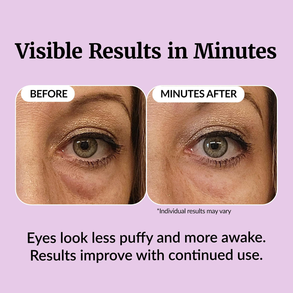 Vibriance Eye Renewal Serum for Mature Skin 0 5 fl oz - Vibriance Official Imagery - 5