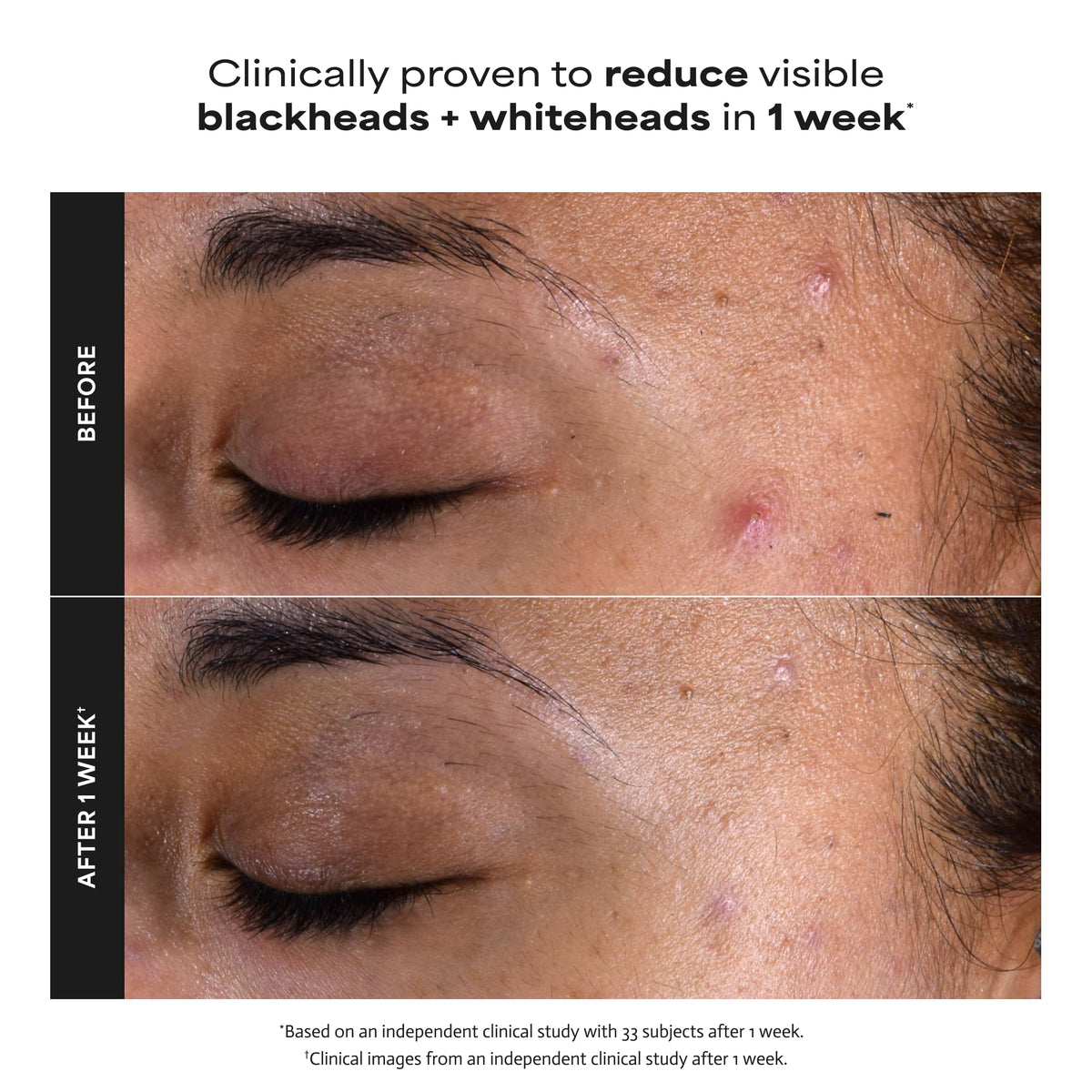 Paula s Choice SKIN PERFECTING 2 BHA Liquid Leave On - Premium Selection Official Imagery - 6