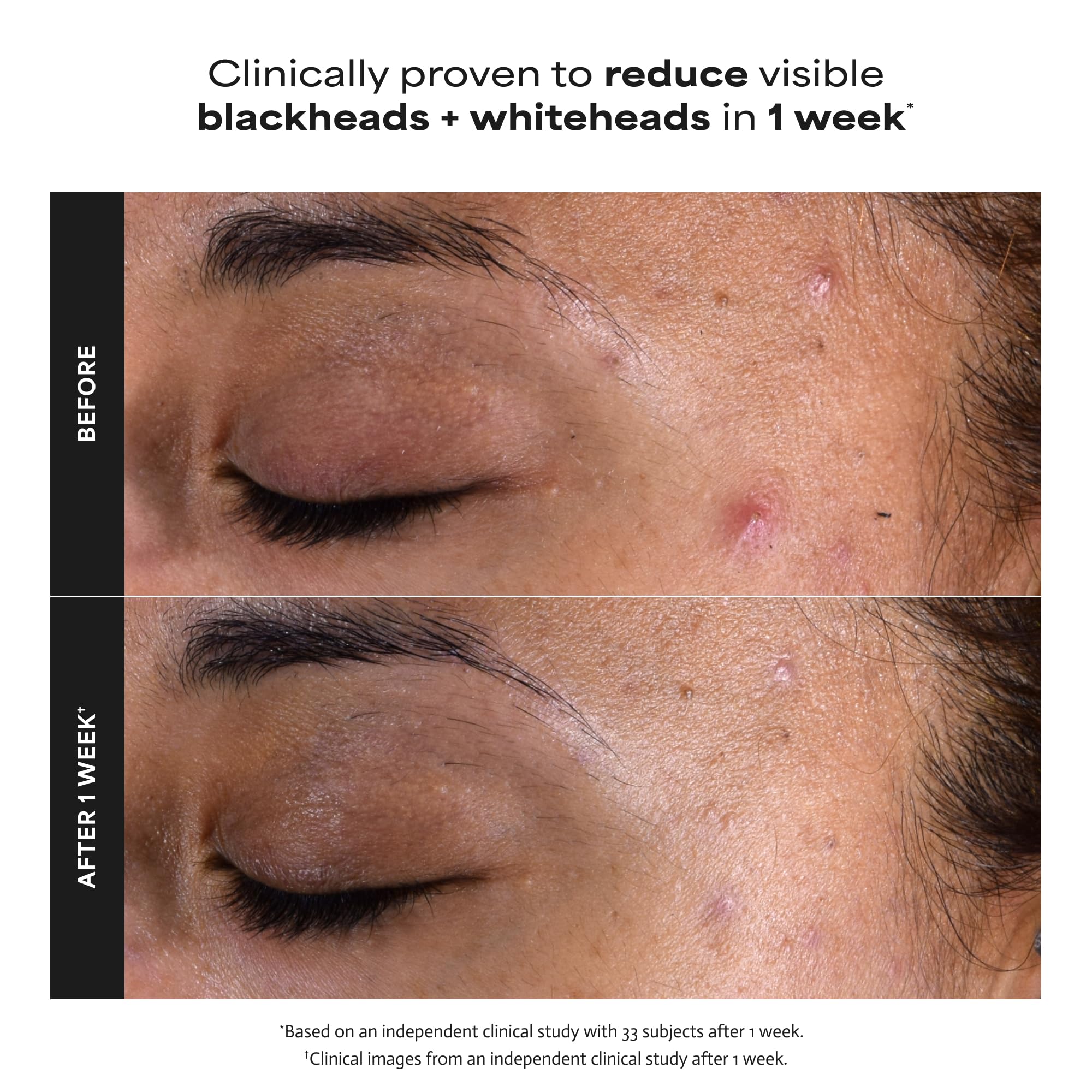 Paula's Choice SKIN PERFECTING 2% BHA Liquid Exfoliant - Elefair Tech Official Product View 6