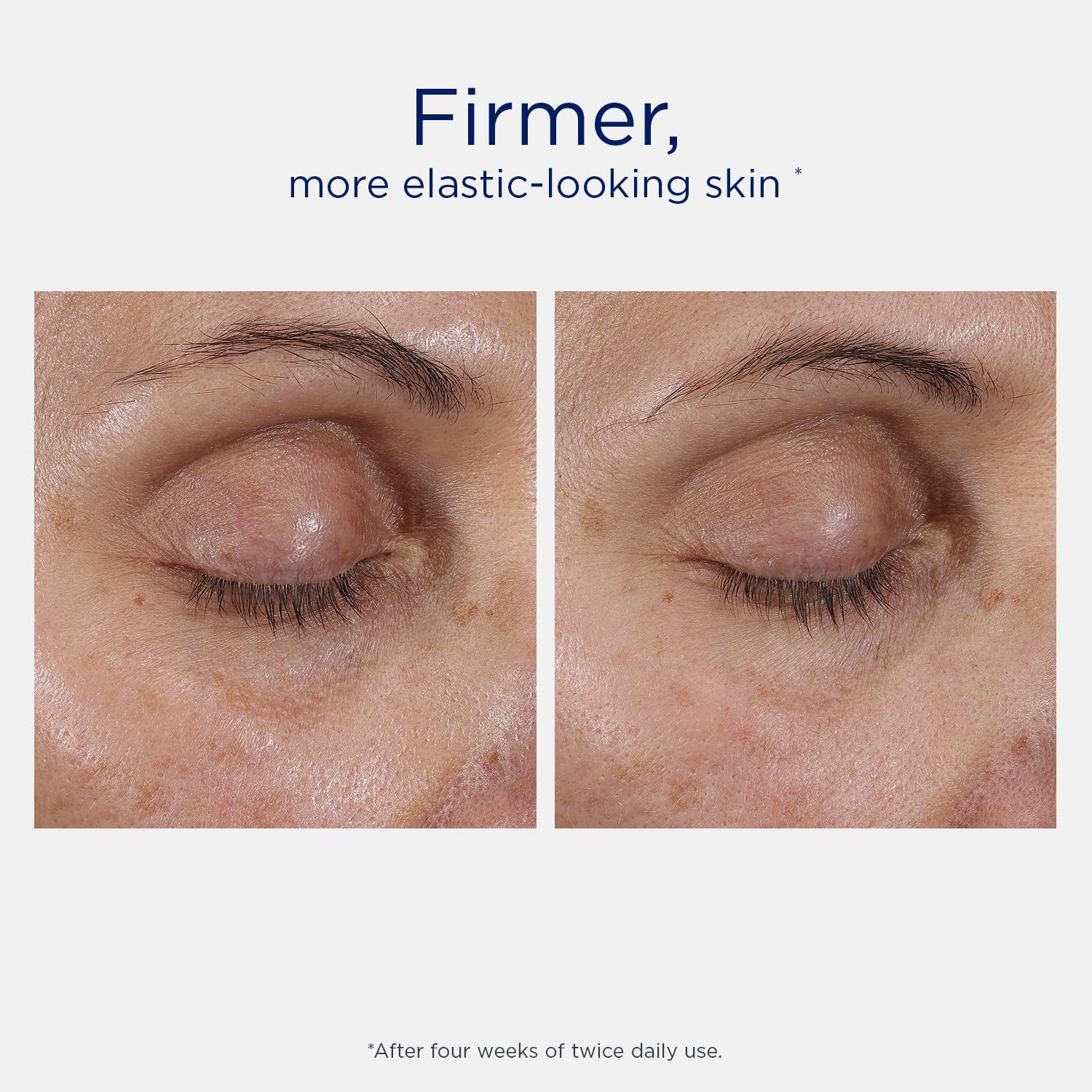 NEOSTRATA SKIN ACTIVE Intensive Eye Therapy Anti Aging Under - Premium Selection Official Imagery - 5