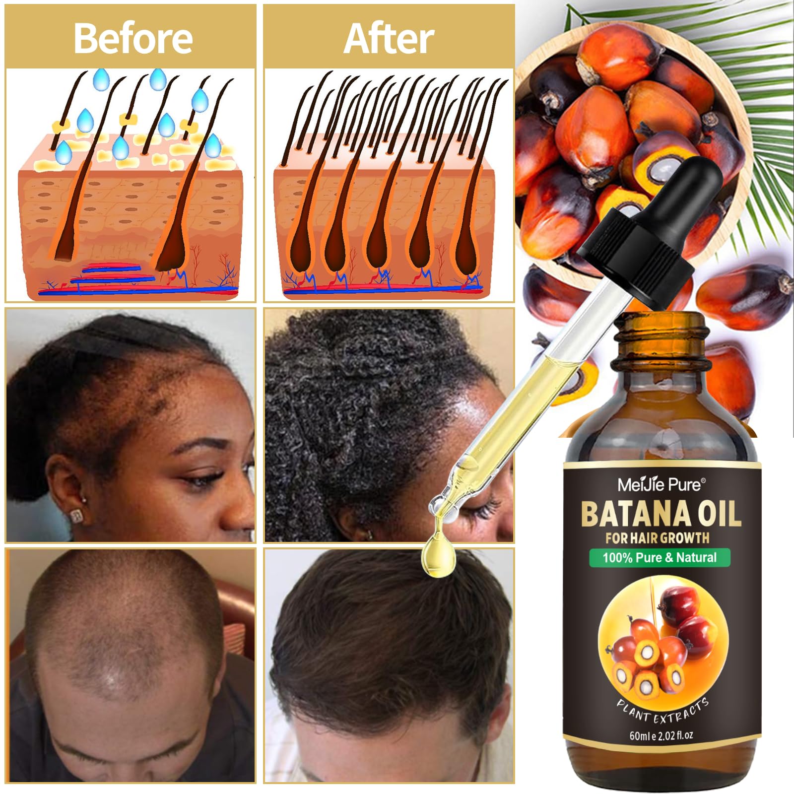 CLOTHES OF SKIN Batana Oil for Hair Growth–4Pc Set - Raw Batana Oil & Hair Mask - CLOTHES OF SKIN Official Product View 3