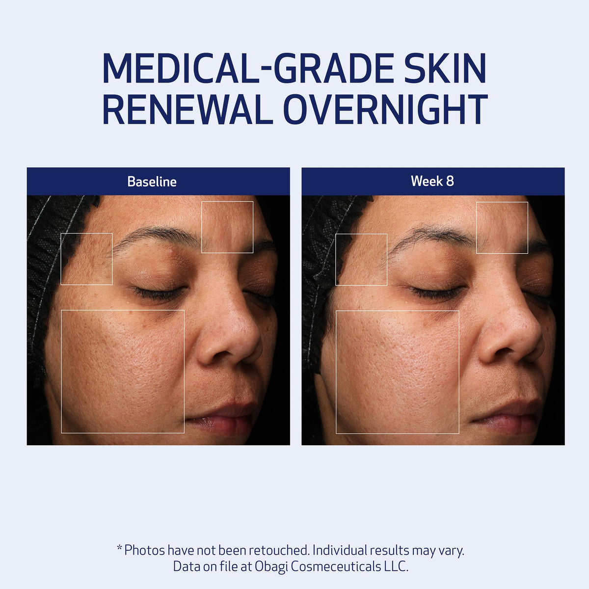 Obagi Medical Retinol PHA Refining Night Cream - Premium Selection Official Imagery - 5
