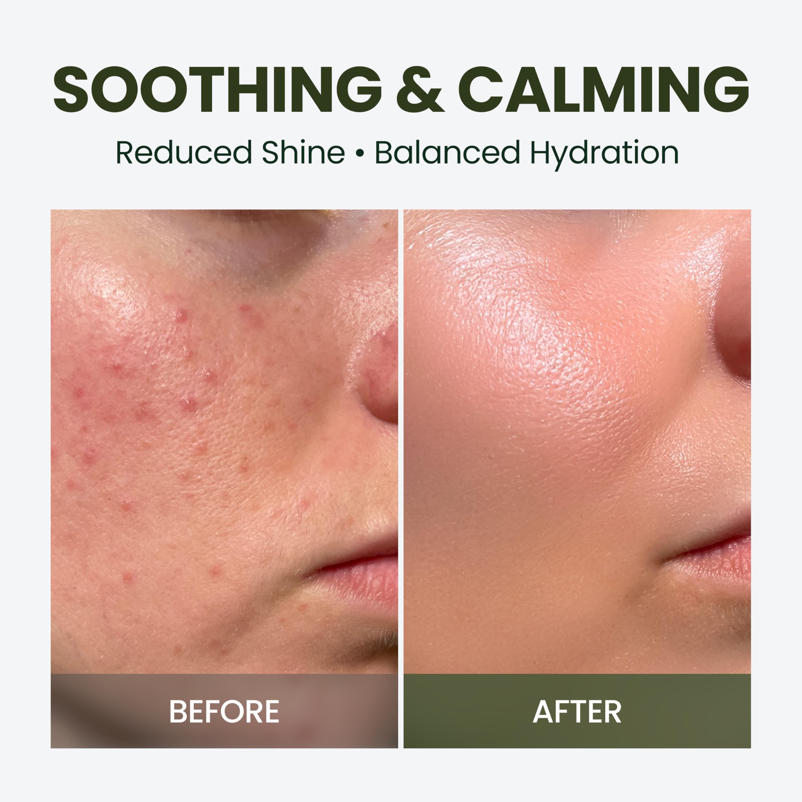 HyCicaMue Defence Cream - elravie Official Imagery - 5