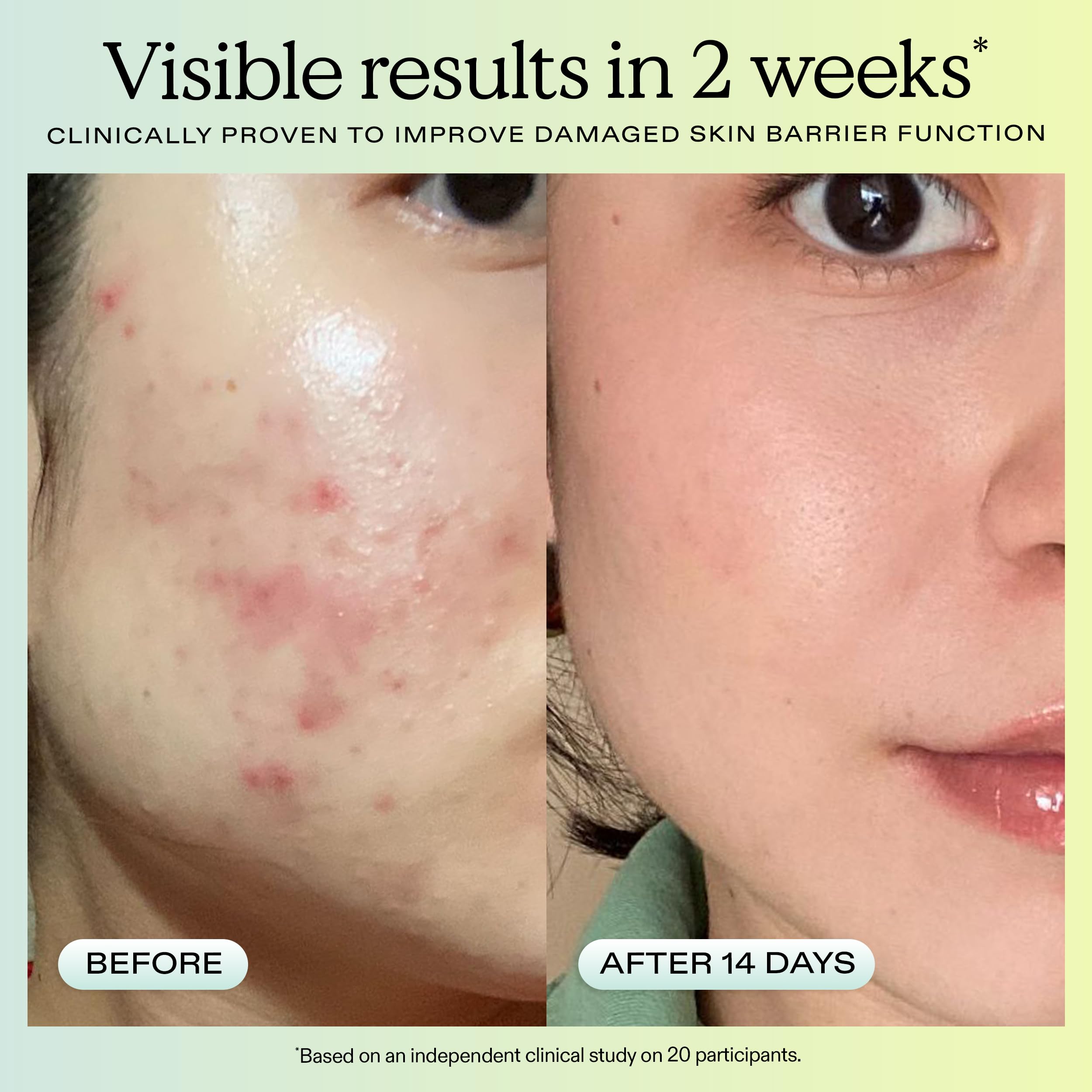 KraveBeauty Great Barrier Relief Face Serum for Dry, Sensitive - KraveBeauty