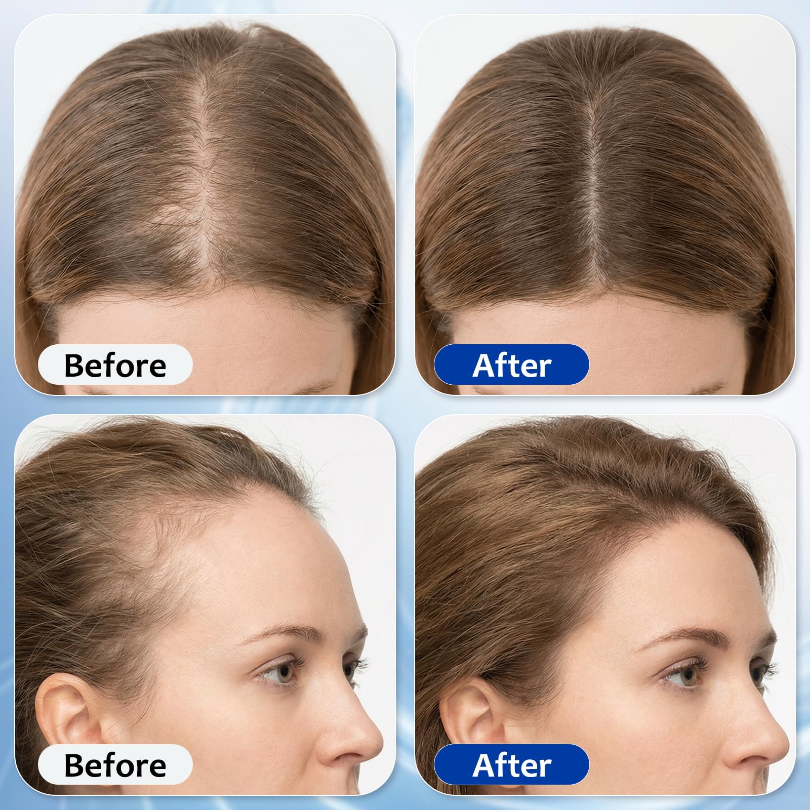 MGVAASURC Hair Growth Serum Roll On with 3% Rosemary,3% Batana Oil,2% Pea - MGVAASURC Official Product View 5