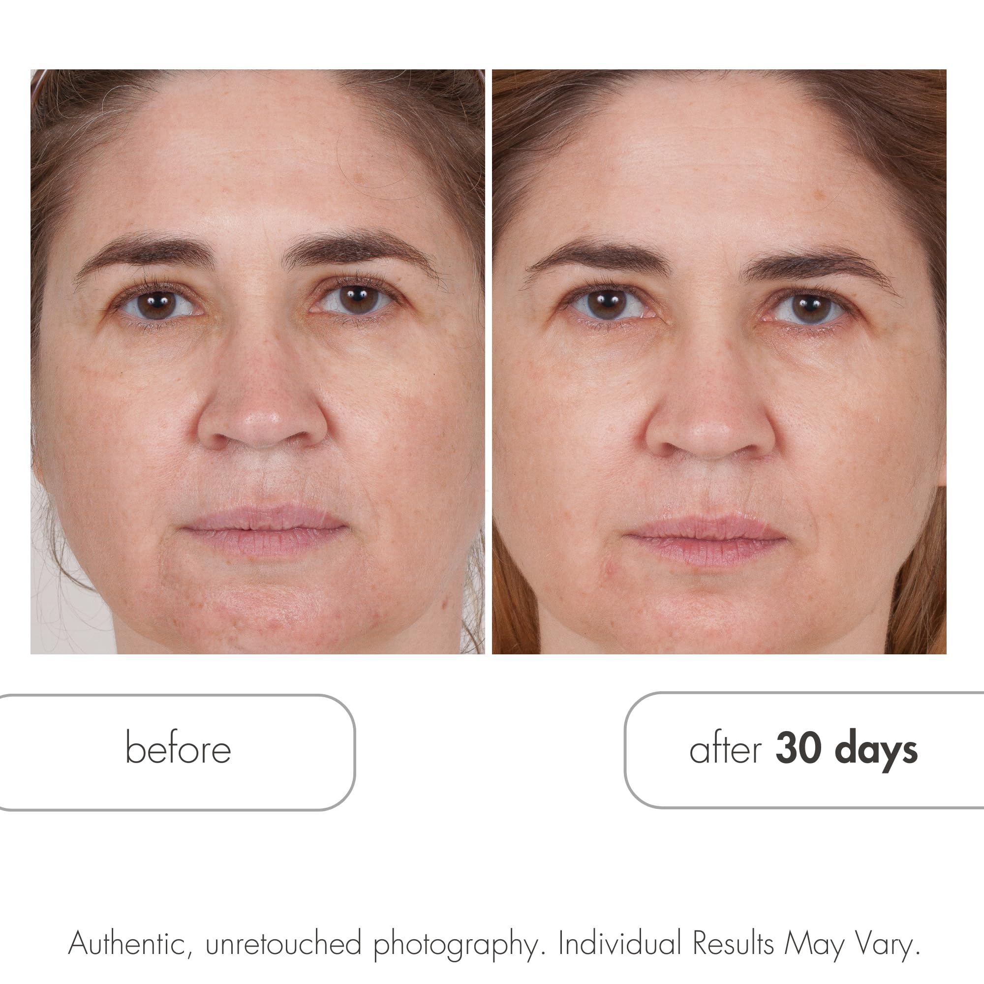Serious Skincare Glycolic Acid Resurfacing Facial Pads 60 - Serious Skincare Official Imagery - 4
