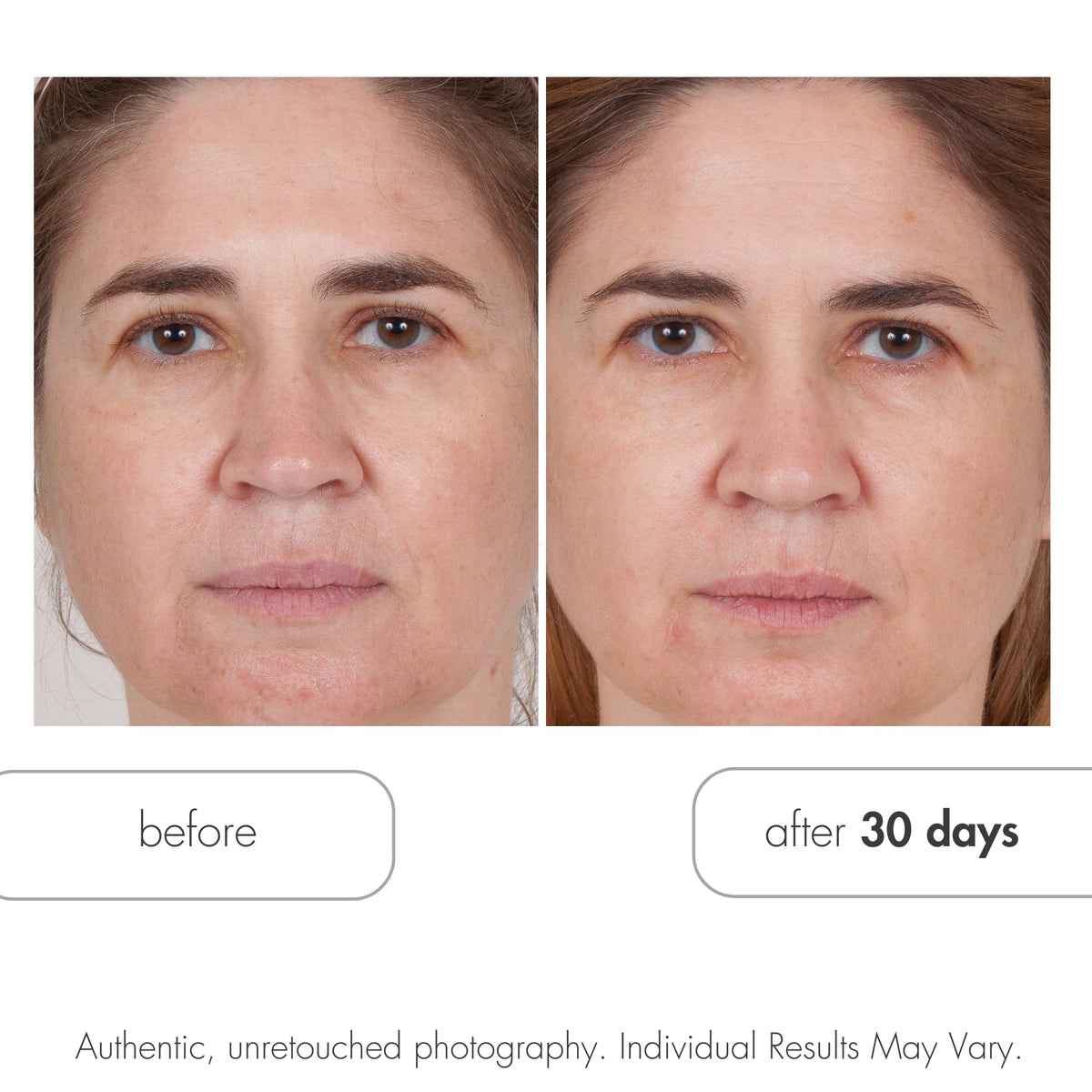 Serious Skincare Glycolic Acid Cleanser Deep Pore Purifying - Serious Skincare Official Imagery - 5