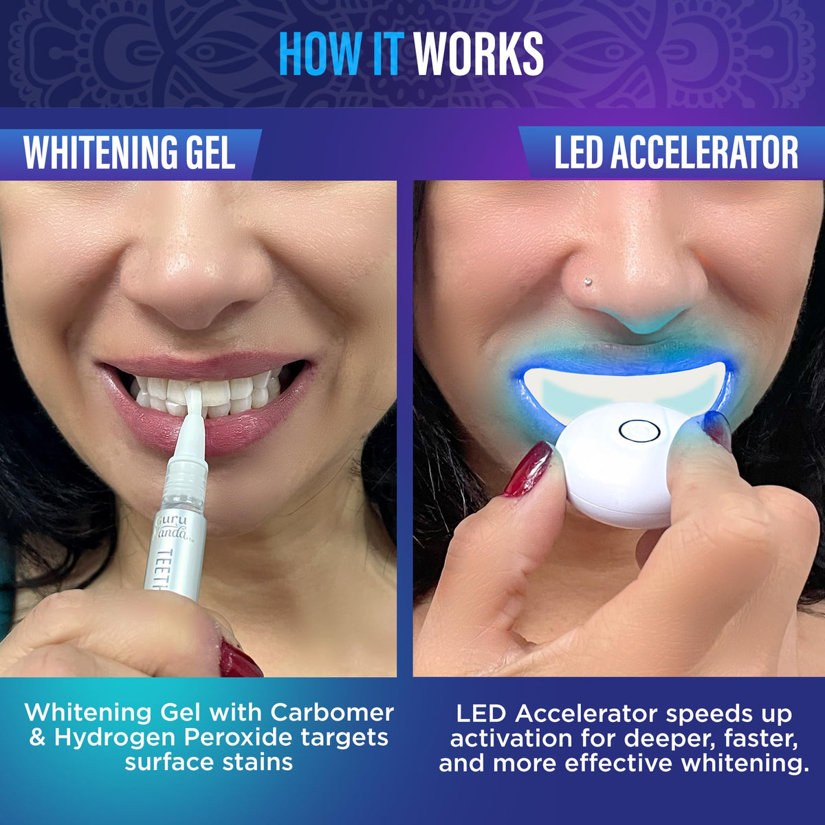 GuruNanda Professional Teeth Whitening Wireless Kit with LED - GuruNanda Official Imagery - 3