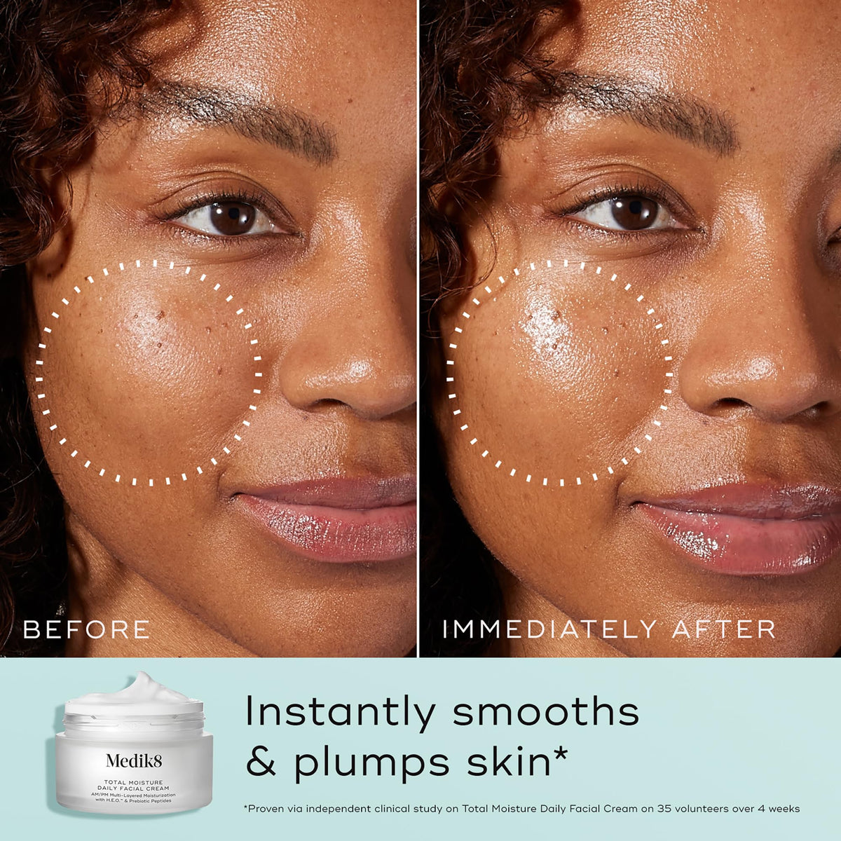 Medik8 Total Moisture Daily Facial Cream - Medik8 Official Imagery - 5