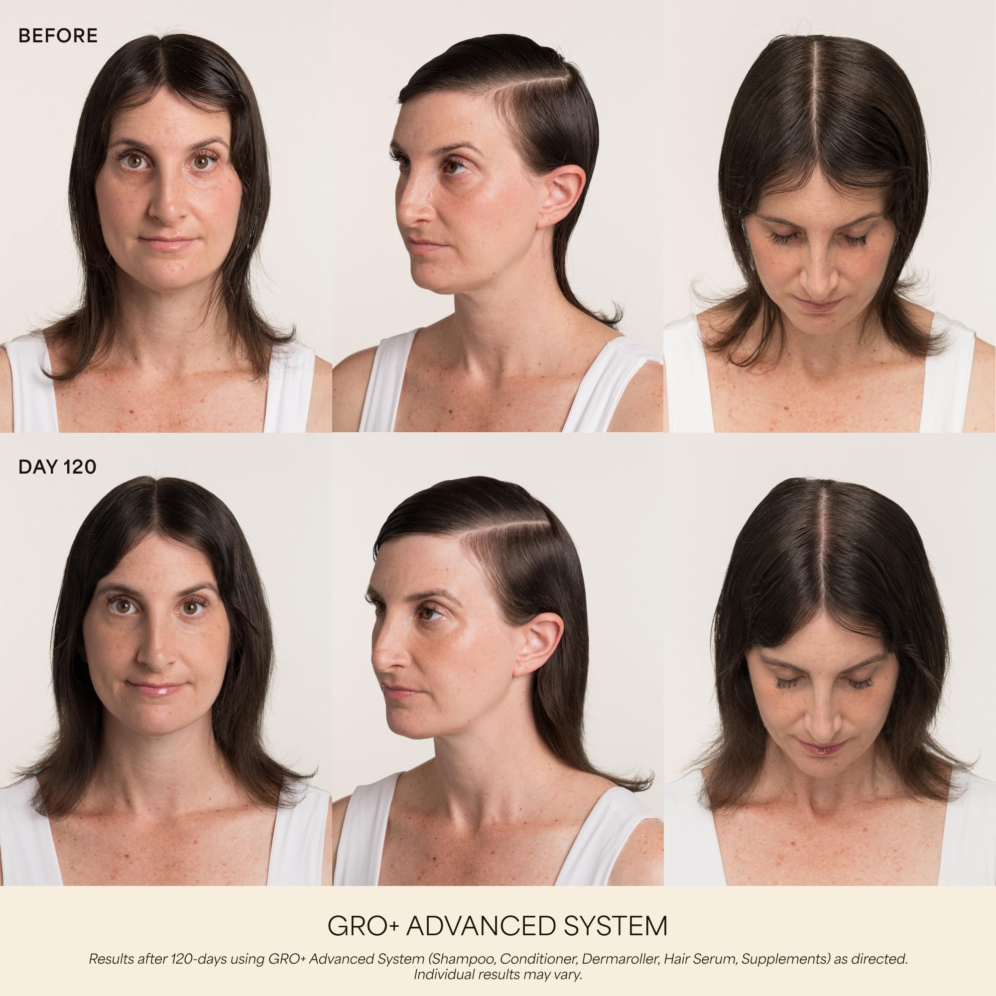 VEGAMOUR Scalp Dermaroller - Premium Selection Official Imagery - 3