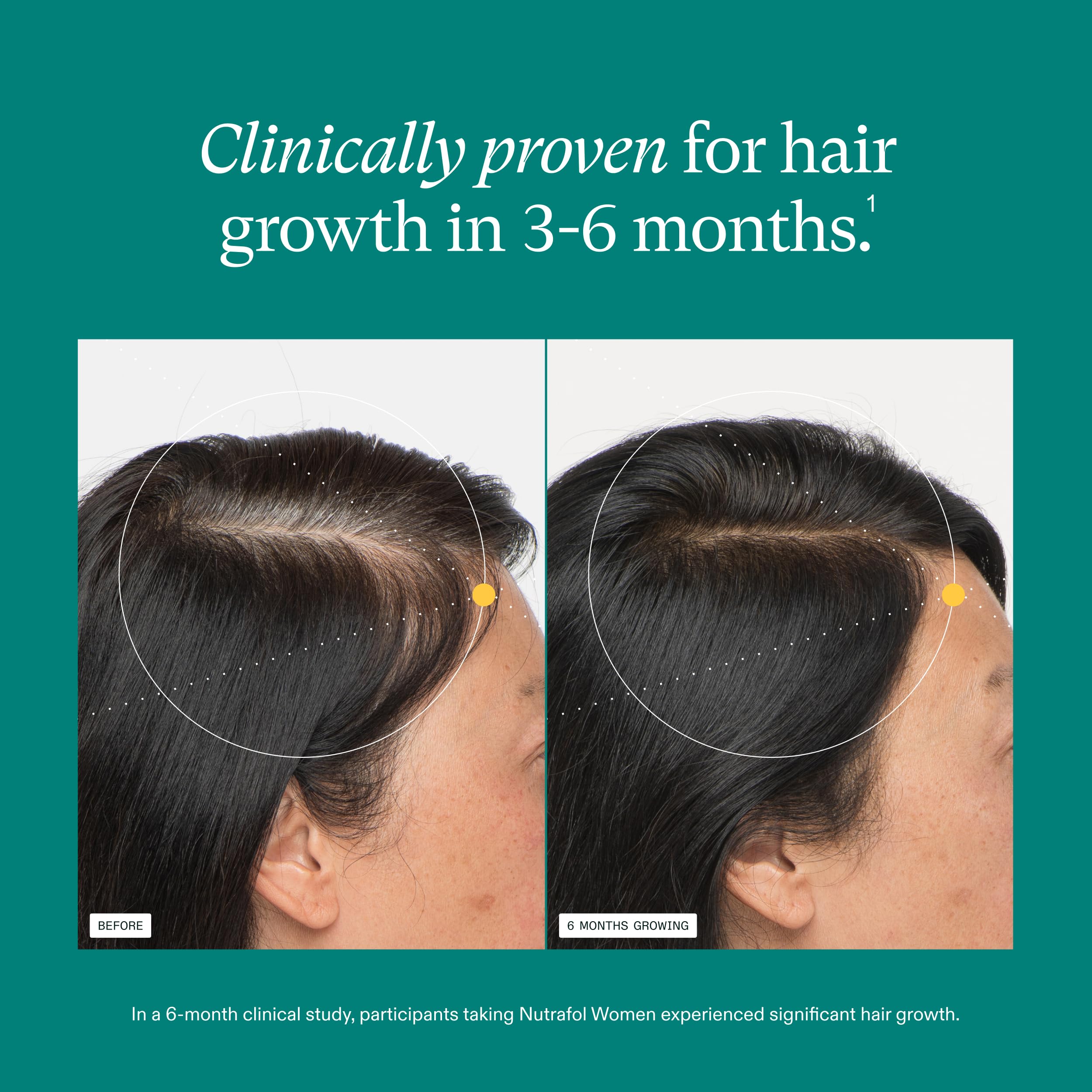 Nutrafol Women Hair Growth Supplements Ages 18 44 1 Month - Premium Selection Official Imagery - 7