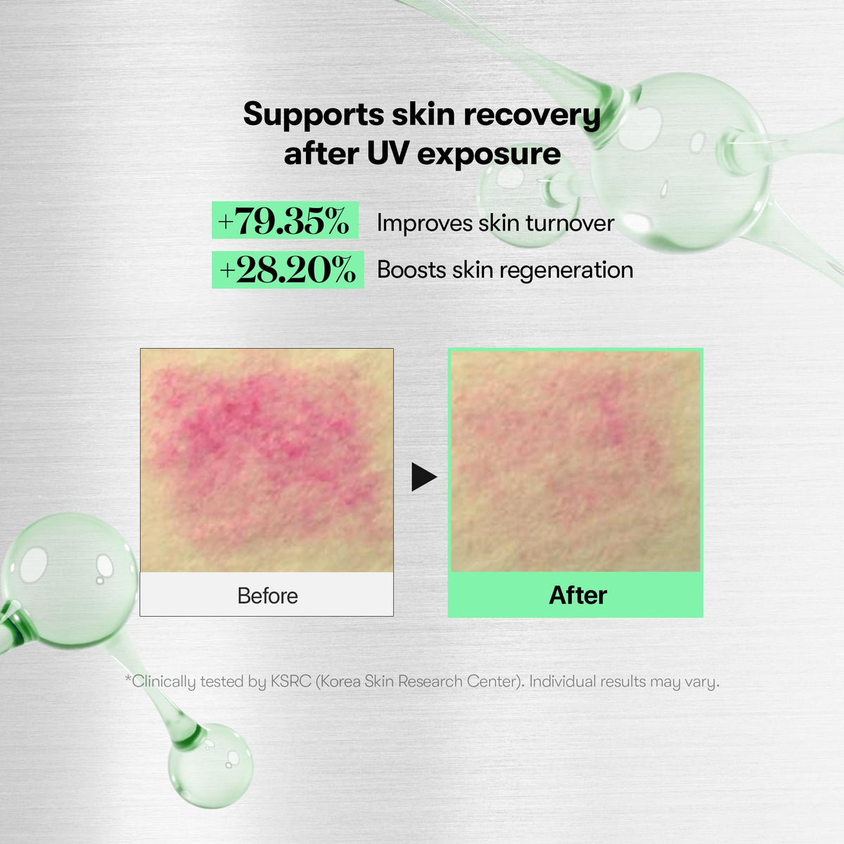 VT COSMETICS CICA Reedle Shot 700 Spicule Microneedling - VT COSMETICS Official Imagery - 5