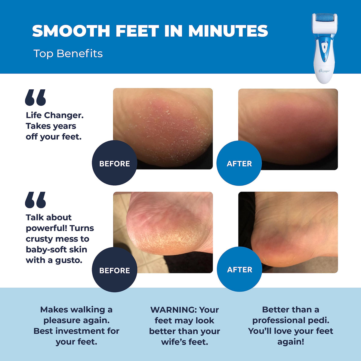 Own Harmony Electric Foot Callus Remover - Own Harmony Official Imagery - 3