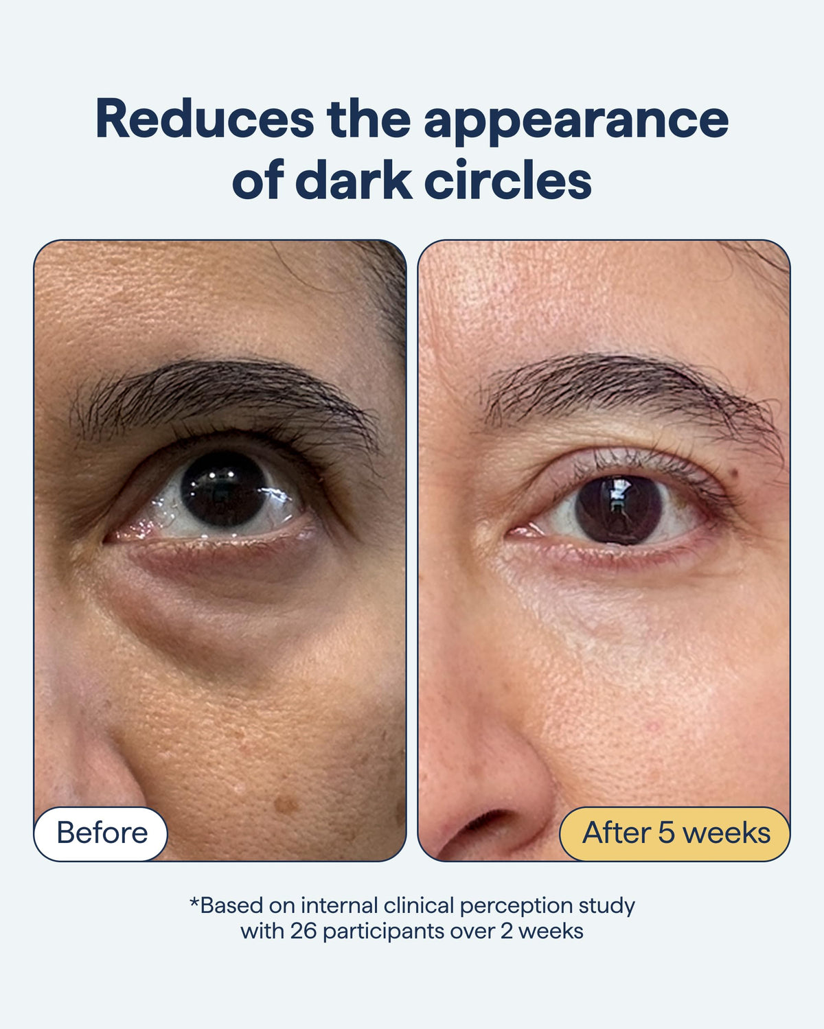 REMEDY Dark Circles Reducing Advanced Eye Cream with - Remedy Science Official Imagery - 4