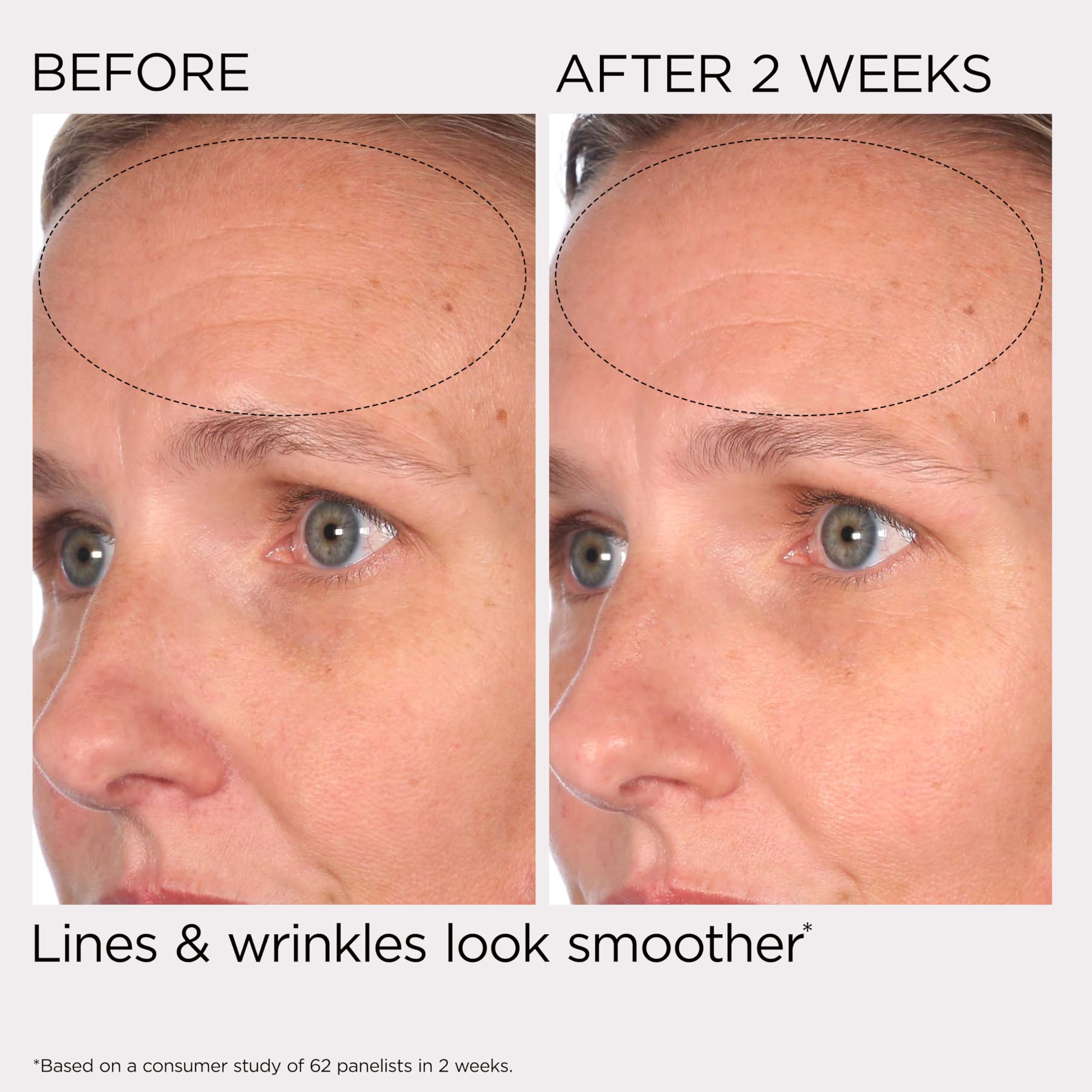 Elizabeth Arden PREVAGE Anti-Aging Face Moisturizer Cream for... - Elefair Tech Official Product View 5