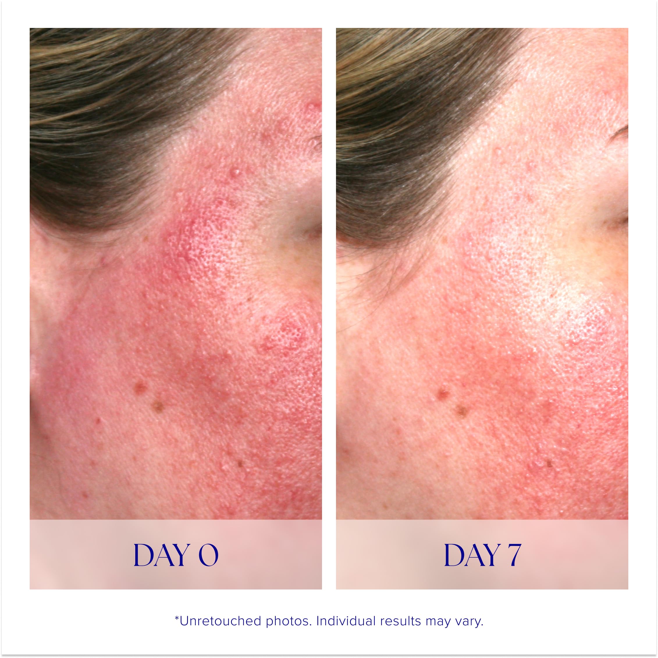 iS CLINICAL Pro-Heal Serum Advance+, Antioxidant-Rich Vitamin C - Generic