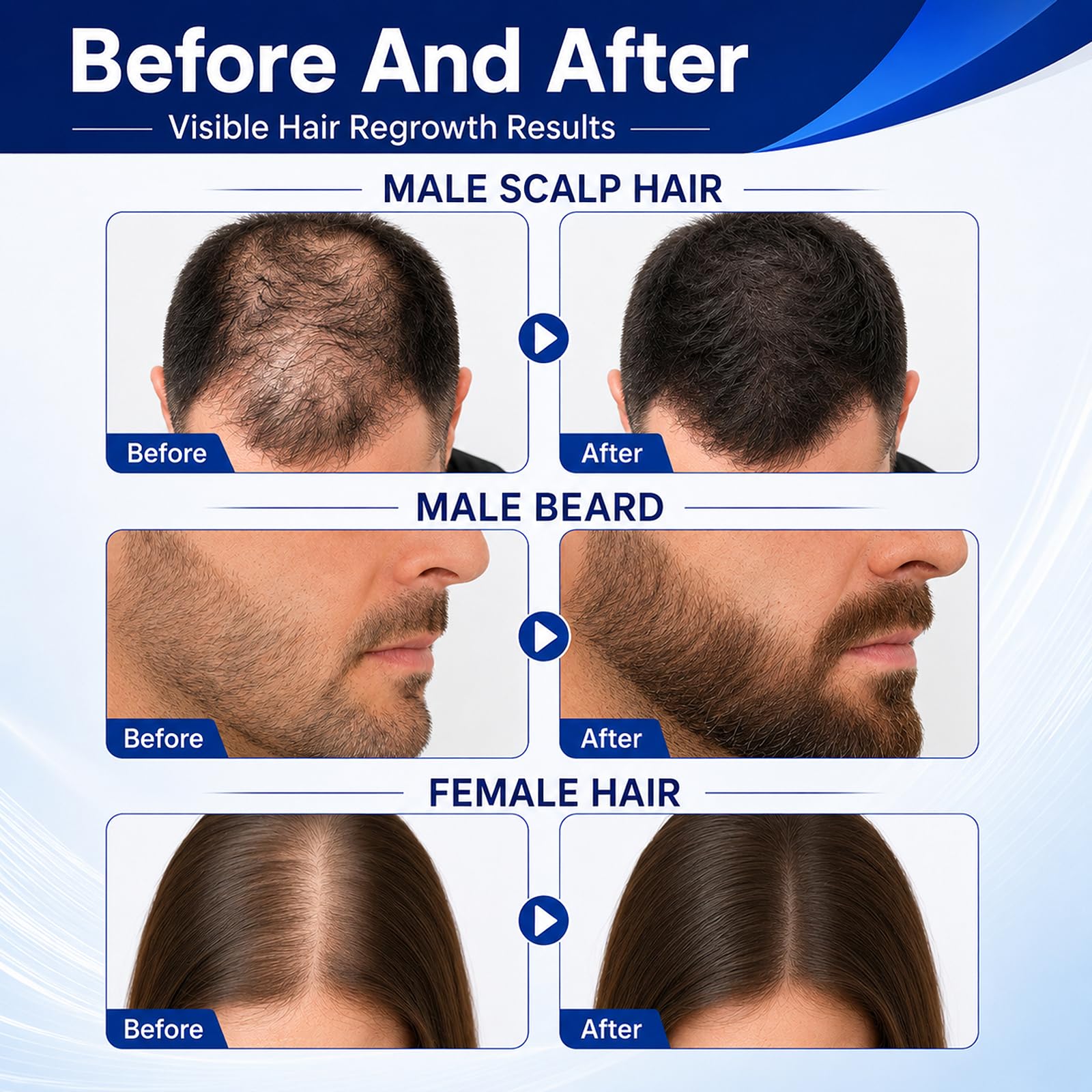 YUEJOIKL 5% Minoxidil and Women Hair Growth, Minoxidil Spray Hair Regrowth with - YUEJOIKL Official Product View 4