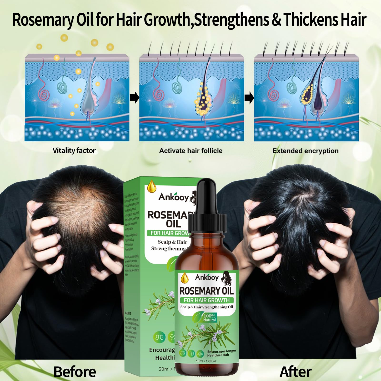 ANKOOY Rosemary Oil for Hair Growth,Rosemary Hair Growth Oil,Strengthening Oil - ANKOOY Official Product View 5