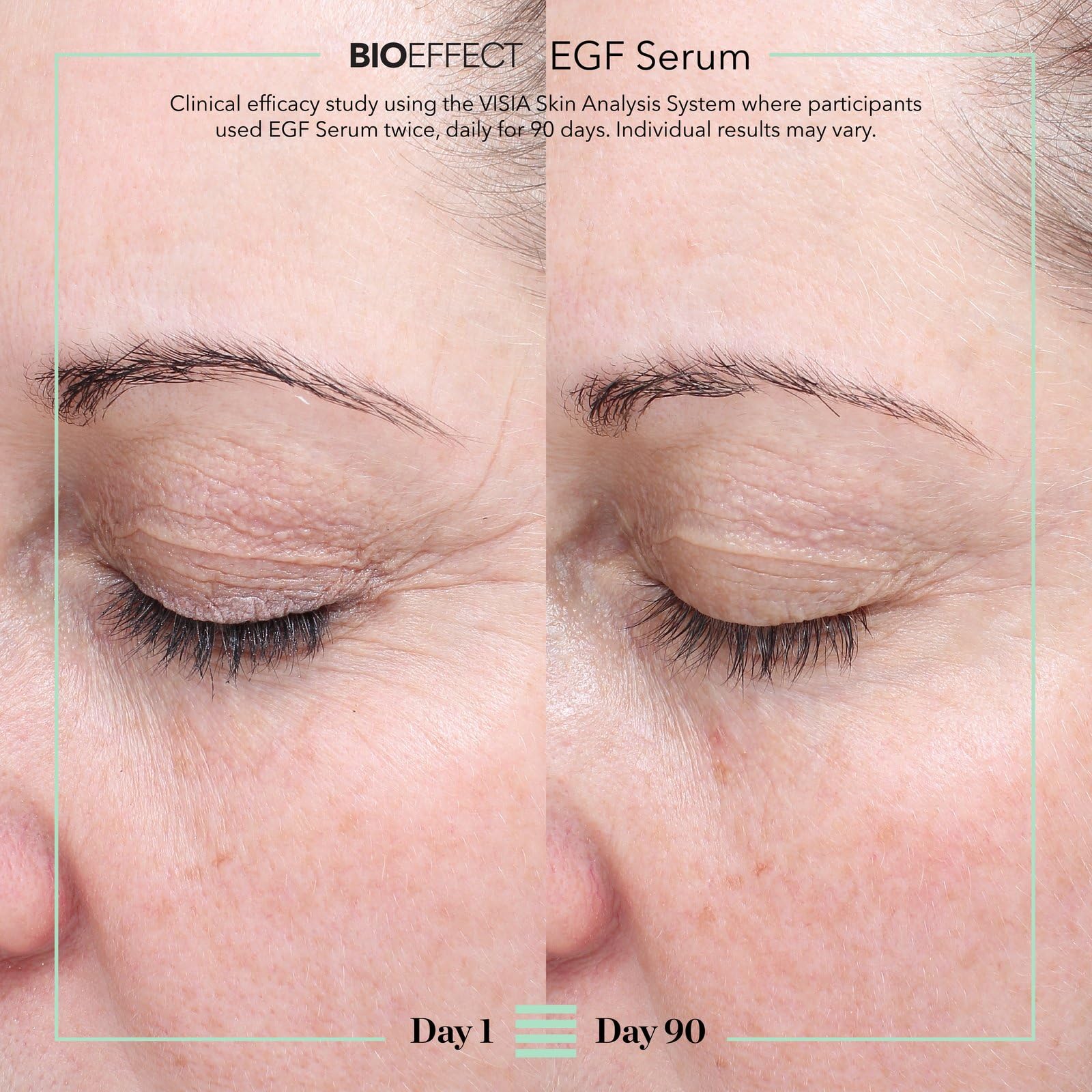 BIOEFFECT EGF Serum, Age-Defying Serum - Generic
