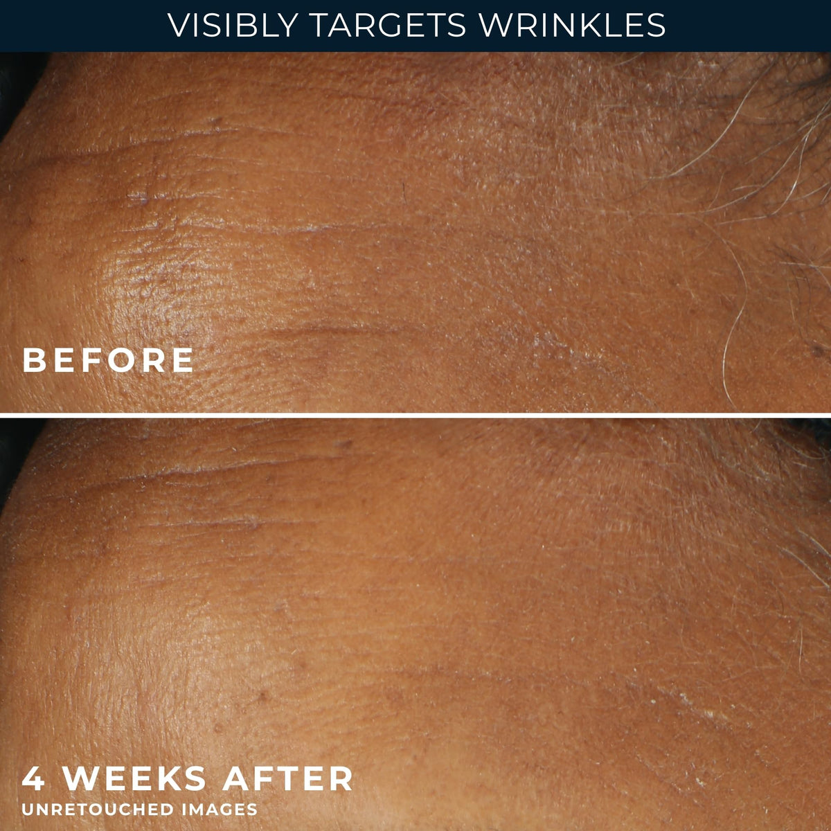 RoC Retinol Correxion Deep Wrinkle Daily Face Moisturizer - RoC Official Imagery - 7