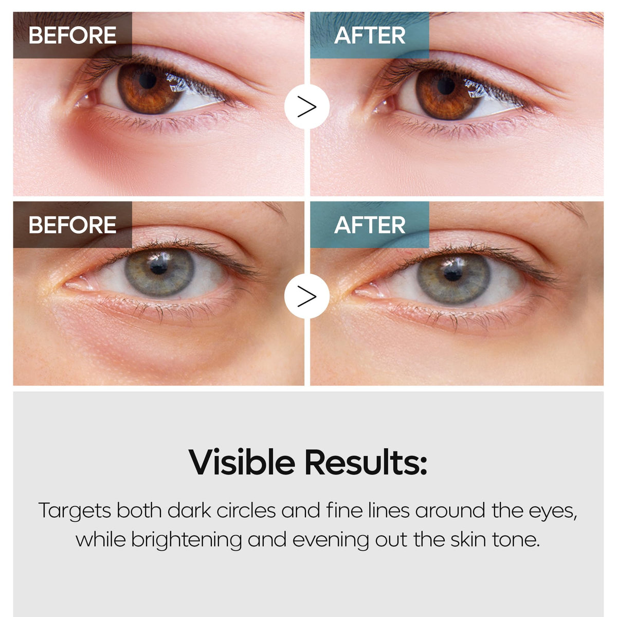DR MELAXIN TX Tranexamic Acid Retinalsome Dual Eye Cream - Dr.Melaxin Official Imagery - 4