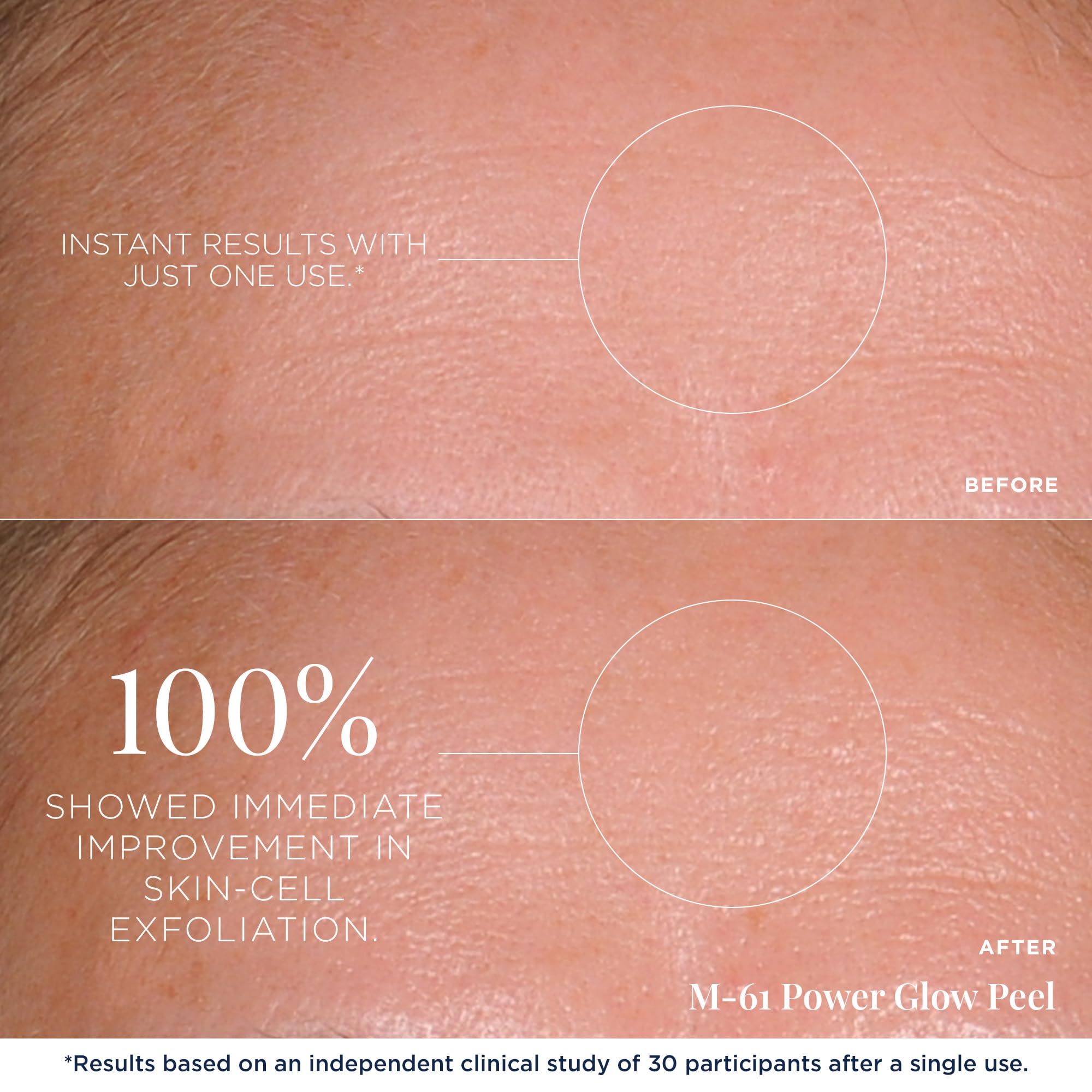 m 61 PowerGlow Peel 30 Treatments - m-61 Official Imagery - 5